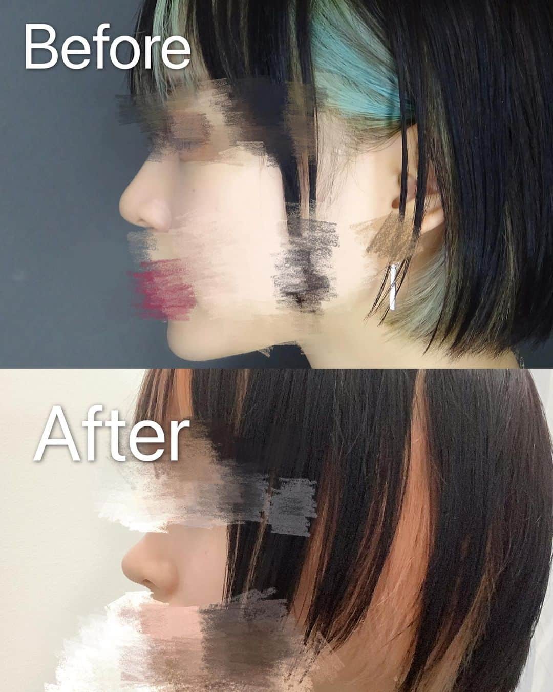 ももかわのインスタグラム：「Beforeの団子鼻から🤧  Afterの上向きな綺麗な鼻になれました☺💕  横から見ても前から見ても上から見てもどこから見ても自然に綺麗な鼻…✨✨✨ 嬉しいです👼🏻🤍🤍🤍  こちらの施術は #tcb式鼻先尖鋭術 👍🏻 ドクターは #吉田慧 先生 👍🏻  本日抜糸をしてきましたが全然痛くありませんでした😮✨  #鼻整形ならtcb東京中央美容外科 #美容整形ならtcb東京中央美容外科 #東京中央美容外科 #美容外科 #渋谷院 #東京中央美容外科渋谷院 #鼻整形」