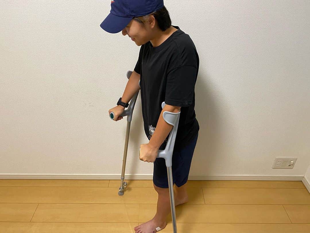 籾木結花のインスタグラム：「スウェーデンでのデビュー戦で左足第5中足骨を綺麗に折ってしまい、今季プレー不可能・手術が必要ということで、日本に帰って来て手術をしました。 ゆっくり、しっかり治して、パワーアップしていきます🤕😁🤟」