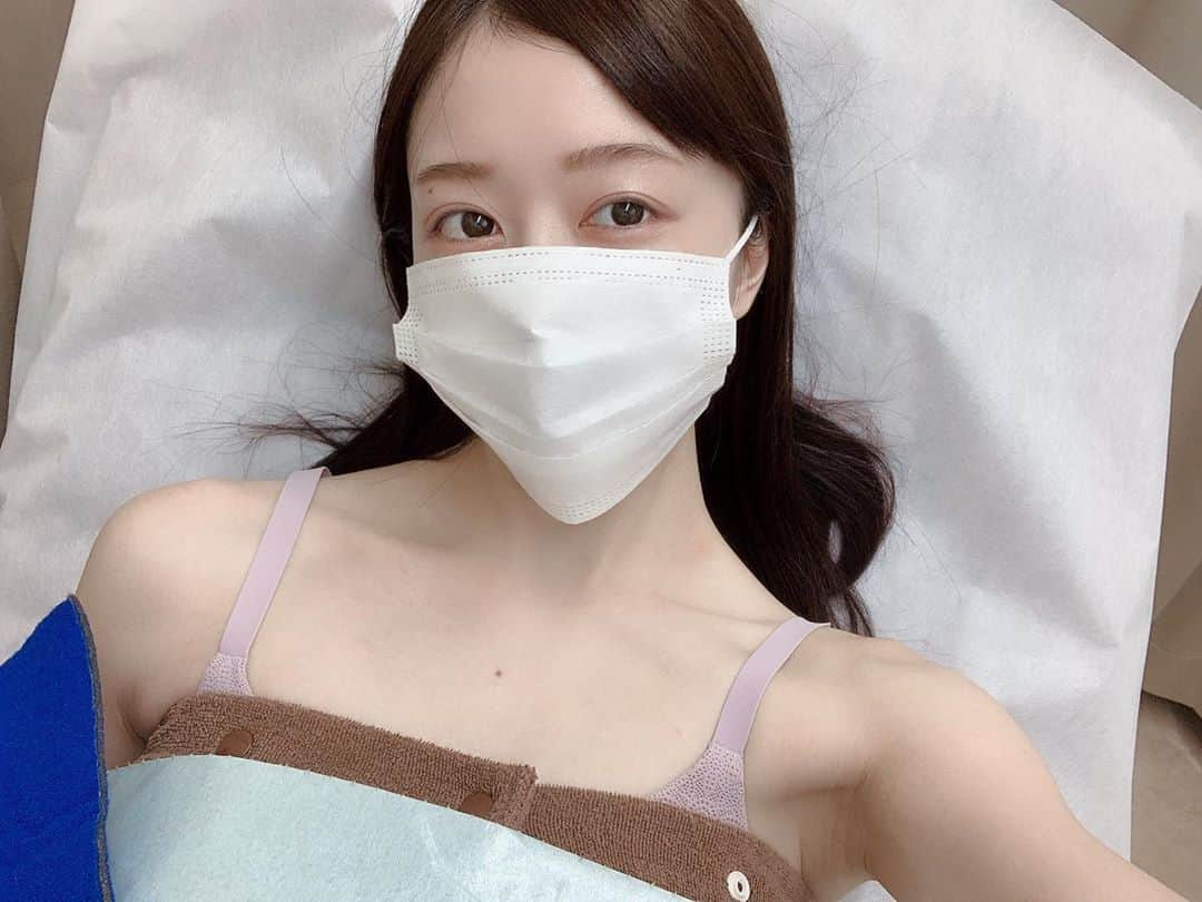 小湊優香さんのインスタグラム写真 - (小湊優香Instagram)「すっぴんすみません·····🥺﻿ ﻿ 湘南美容クリニック新橋銀座口院の﻿ 酒井先生 ＠sbc_sakai にカウンセリングをしてもらい﻿ クールスカルプティングの施術を行いました✨﻿ 先生お綺麗だった·····🥺✨﻿ ﻿ クールスカルプティングとは何ぞや？！って﻿ 思いますよね😳😳😳﻿ ﻿ 簡単に言うと﻿ 切らない脂肪吸引✨冷却で脂肪を破壊✨です！﻿ ﻿ 脂肪減少作用について厚労省が唯一認証した﻿ 医療機器なのです😳😳😳﻿ ﻿ 脂肪吸引は怖いけどどうにか痩せたいって方におすすめ✨﻿ ﻿ 私は上腹部をやってもらいました！﻿ 最初の10分は低温火傷のような感じと﻿ 肉をつままれてる感じで少し痛いけど﻿ 麻痺していき、余裕で携帯ゲームして遊んでた🤣✌️﻿ ﻿ 終わったあとのマッサージが1番痛い！(笑)﻿ ﻿ 直後からスッキリした感じで嬉しかった〜❤️﻿ 2.3ヶ月くらいかけて脂肪がゆっくり減るので﻿ そのくらいに効果を実感できるみたい！﻿ ﻿ 直後のビフォアフ載せときます！﻿ 少し内出血してるけど翌日は治ってました✨﻿ ﻿ 効果出るの楽しみだな〜✨﻿ ﻿ ﻿ #湘南美容クリニック #湘南美容 #美活 #美容 #新橋銀座口院 #美容day #自分磨き #綺麗になりたい #美意識 #湘南レポ ﻿  #sponsoredbyBC  #美容皮膚科 ﻿ #クールスカルプティング ﻿」9月14日 15時47分 - y.miranic