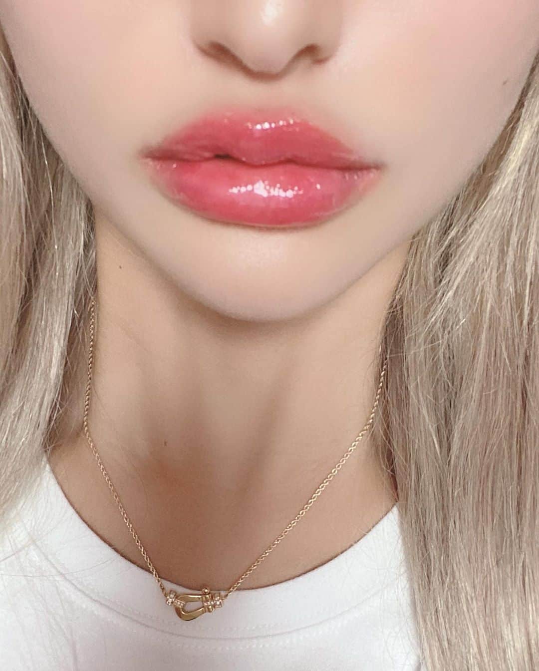 ぱぴさんのインスタグラム写真 - (ぱぴInstagram)「. . good morning🌞  唇ちゃんまたデザイン変えて ボリュームだしてもらった🥰💋 前の形も好きだったけど、やっぱ ボリュームありが好き〜っ🤩 それと25歳になりお肌の曲がり角突入して 最近ほうれい線も気になりだしたから 定期的にステムサップってゆう幹細胞の注射💉 打ってる😊コレはヒアルロン酸とまた 違って栄養みたいな感じかな🤔✨ とにかくコレがいいのよっ😆！w 少しでも歳とりませんよーに🥺  今回も箱田先生にお願いしたよ🥰 ほんとお上手で一緒になって考えてくれて 患者さん想いの優しい箱田先生が大好き😍 . . #モデナクリニック #箱田美菜 #福岡大名  #唇のヒアルロン酸 #ジュビダームボリューマ  #ステムサップ #幹細胞上清液 #アンチエイジング  #modenaclinic」9月19日 8時06分 - papikotan0206