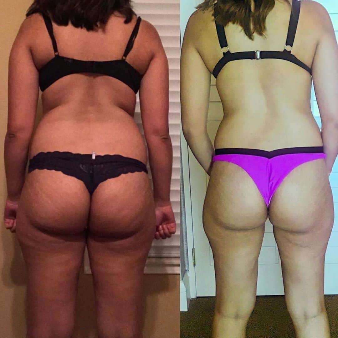 Ainsley Rodriguezさんのインスタグラム写真 - (Ainsley RodriguezInstagram)「LETS TALK CELLULITE!! Give it up for my client Daniella after just 4 weeks with me! . SO many of you ladies flood my DM in disbelief that my clients are able to reduce the appearance of their cellulite because ‘you can’t get rid of it’. That last statement is true - there is no ‘cure’ for cellulite but you can definitely reduce the appearance of it! . Most of us DO have cellulite and it occurs when connective fibers under the skin become weak or lose their elasticity, but stretching and strengthening those areas (in addition to burning away excess fat overall) can help! Notice how I said STRENGTHENING - this means that if you’re suffering from cellulite, strength training and building muscle are going to help tighten the area and cardio is NOT your answer! . Diet and exercise alone won’t determine if you get cellulite or not but it can help those connective fibers responsible and sure as heck can help reduce the appearance of it! 😍 . Client spots for next week NOW OPEN! DM your email for info 📬」9月19日 9時47分 - ainsley