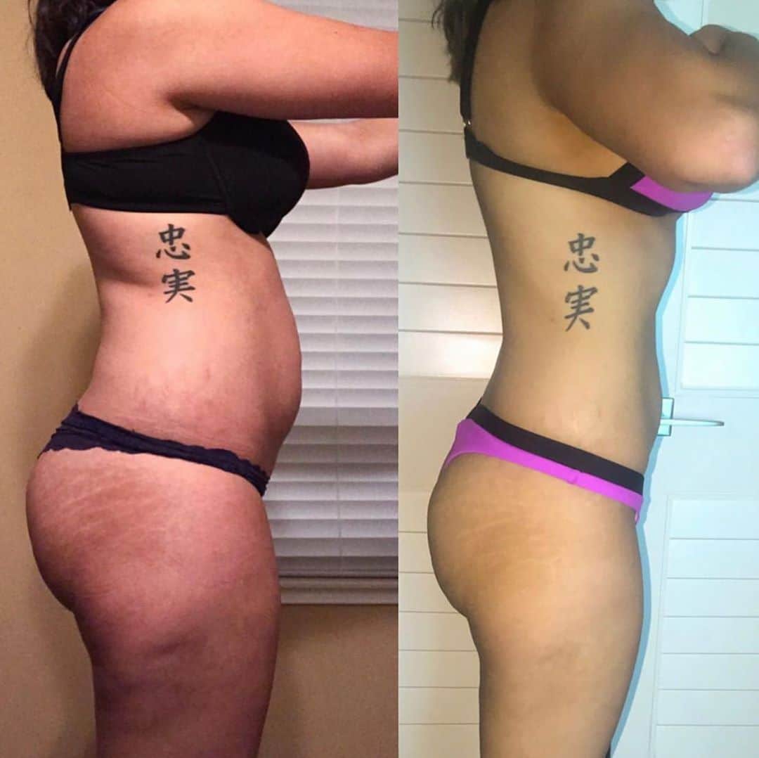 Ainsley Rodriguezさんのインスタグラム写真 - (Ainsley RodriguezInstagram)「LETS TALK CELLULITE!! Give it up for my client Daniella after just 4 weeks with me! . SO many of you ladies flood my DM in disbelief that my clients are able to reduce the appearance of their cellulite because ‘you can’t get rid of it’. That last statement is true - there is no ‘cure’ for cellulite but you can definitely reduce the appearance of it! . Most of us DO have cellulite and it occurs when connective fibers under the skin become weak or lose their elasticity, but stretching and strengthening those areas (in addition to burning away excess fat overall) can help! Notice how I said STRENGTHENING - this means that if you’re suffering from cellulite, strength training and building muscle are going to help tighten the area and cardio is NOT your answer! . Diet and exercise alone won’t determine if you get cellulite or not but it can help those connective fibers responsible and sure as heck can help reduce the appearance of it! 😍 . Client spots for next week NOW OPEN! DM your email for info 📬」9月19日 9時47分 - ainsley