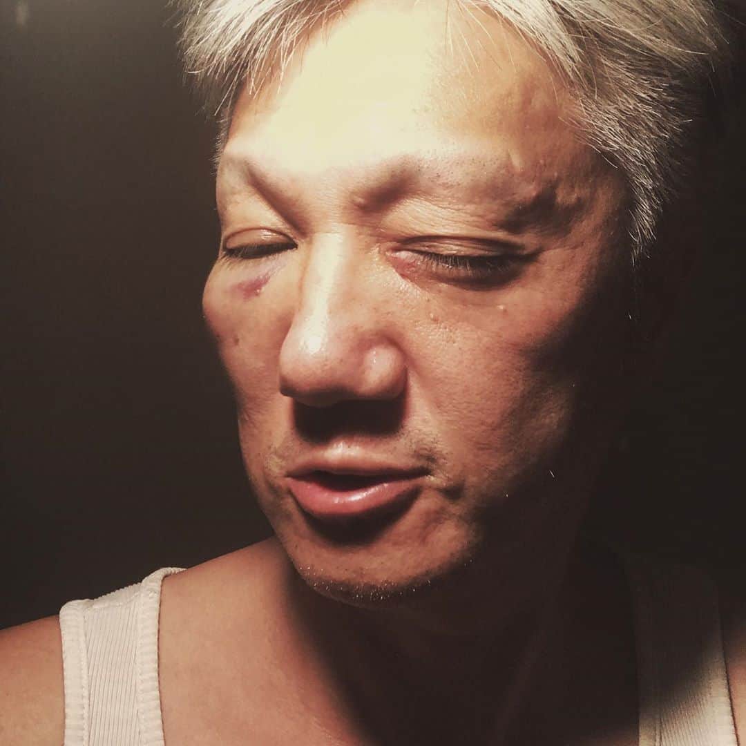 のインスタグラム：「✴︎自慢じゃないがガキどもに ぶん殴られたよ あはは 新宿歌舞伎町大好き  #imaiakinobu  #イマイアキノブ」
