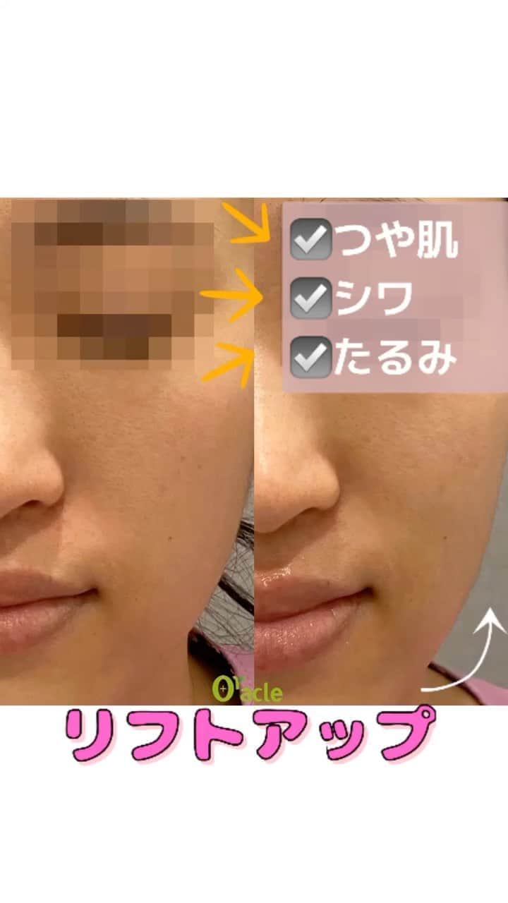 オラクル美容皮膚科東京新宿院のインスタグラム