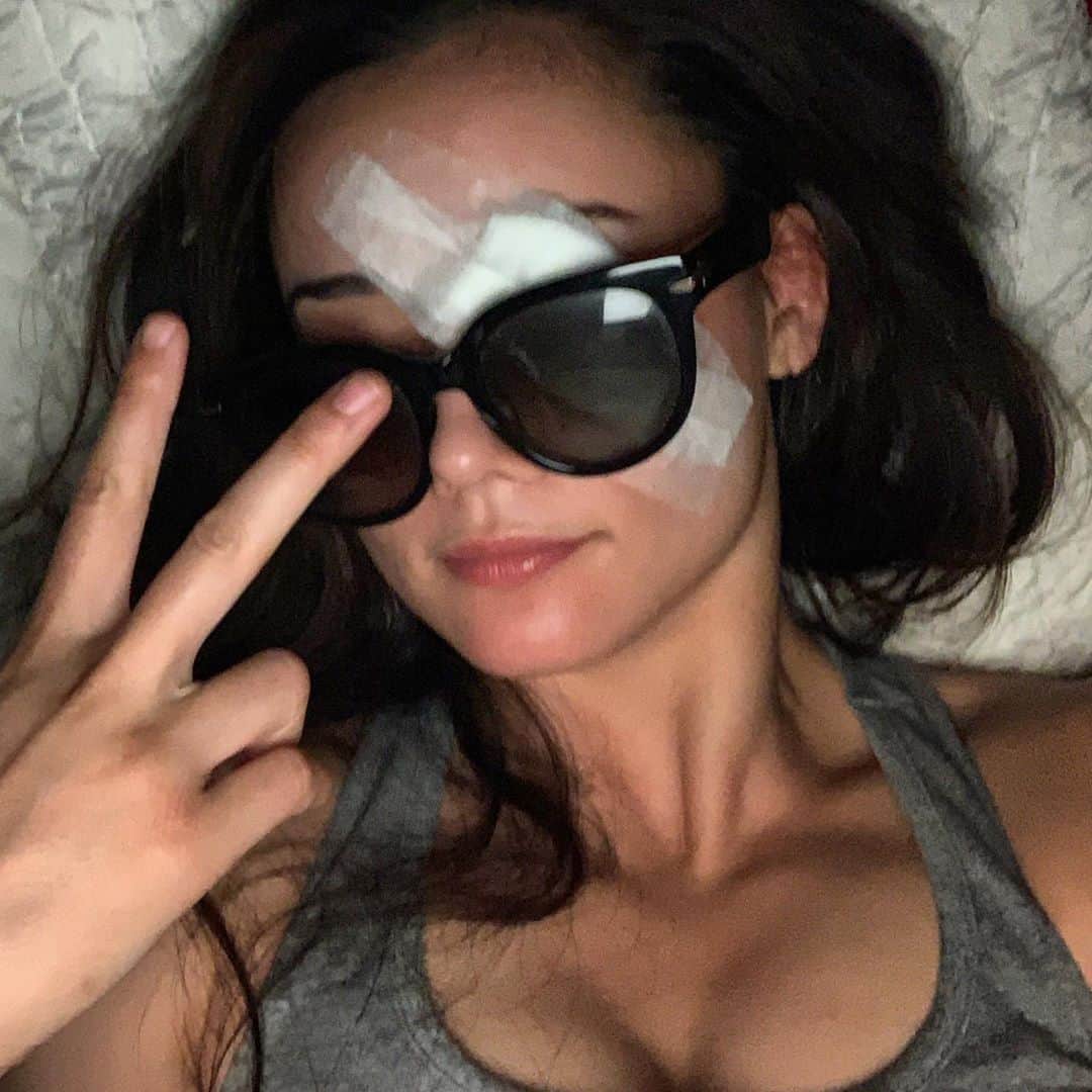 のインスタグラム：「New retina, what’s gooood  目の手術をしました！大丈夫です😎」