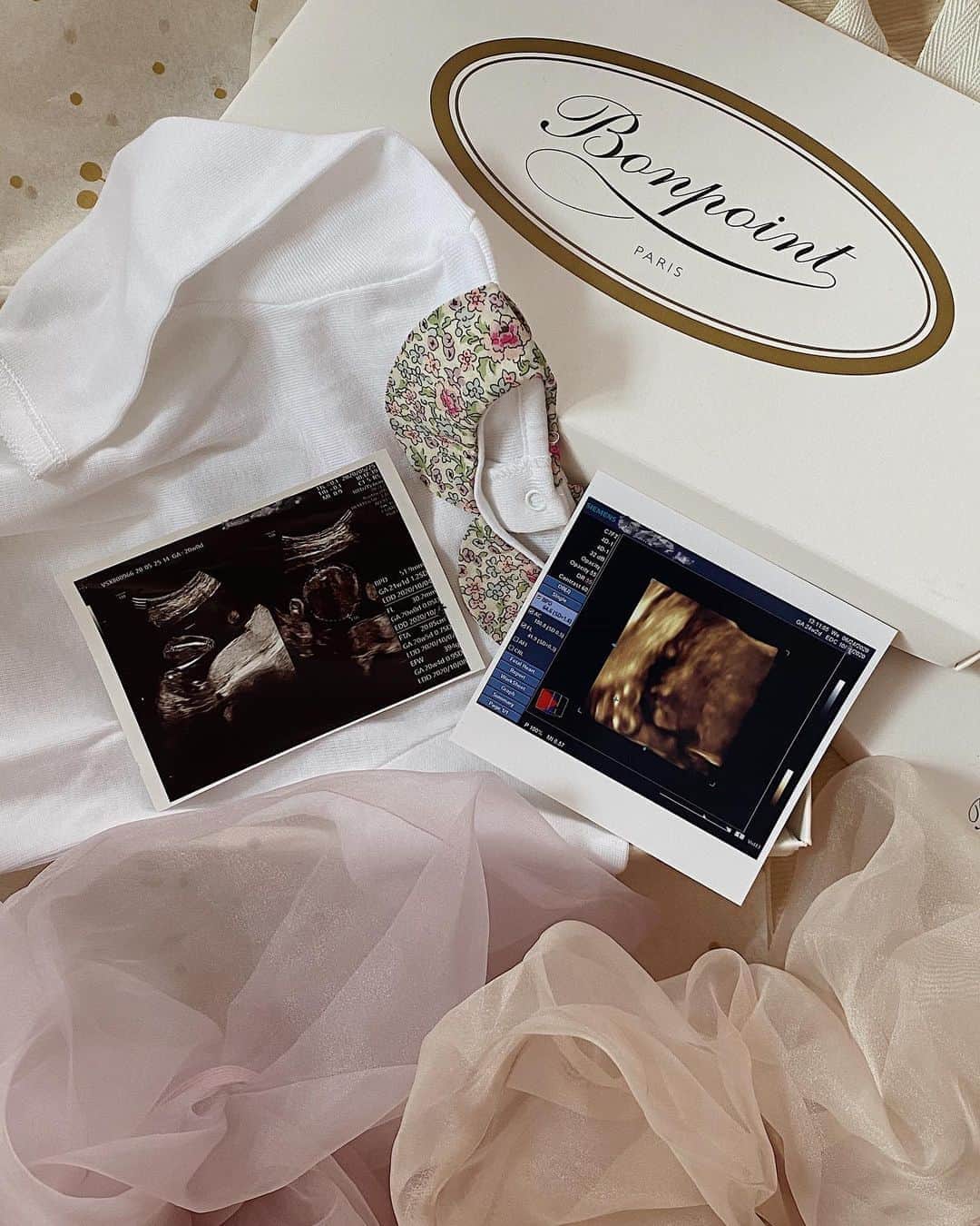 目見田早弥子のインスタグラム：「👶🏻🎀 It's a girl!🤍💕 ⠀ ６ヶ月から９ヶ月に入る頃までずっと 「７割女の子だと思う」と言われ続け、 確定がもらえてなかったので お友達にもはっきりとどっちと言えなかったのですが😂 二人目も女の子でした◯ 私は４歳下の弟との二人きょうだいなので 勝手に二人目は男の子かな〜と思ってましたが 姉妹に憧れていたので嬉しい🤍 (良い意味で、どちらでも良かったです👌🏻) ⠀ 二人目は思い出に残るような はっきりお顔が写ったエコーが全くなく..😢 東京で通ってた病院はある程度の週数がきたら 健診のたびに4Dを撮ってくれる病院だったのですが いつも背中を向いてるからと 4Dもこれ１枚しか撮ってもらえませんでした😂 上の子も背中ばっかり向いてたし はっきり4Dでお顔撮れてるママさんたち羨ましい〜！（笑） ⠀ どんな姉妹になるのか、楽しみです🤍 ⠀ @bonpoint の可愛いお洋服は @nanami311_ ちゃんからお祝いでいただいたもの🥺💕 素敵なお祝いをありがとう、早く着せたい💭♡」