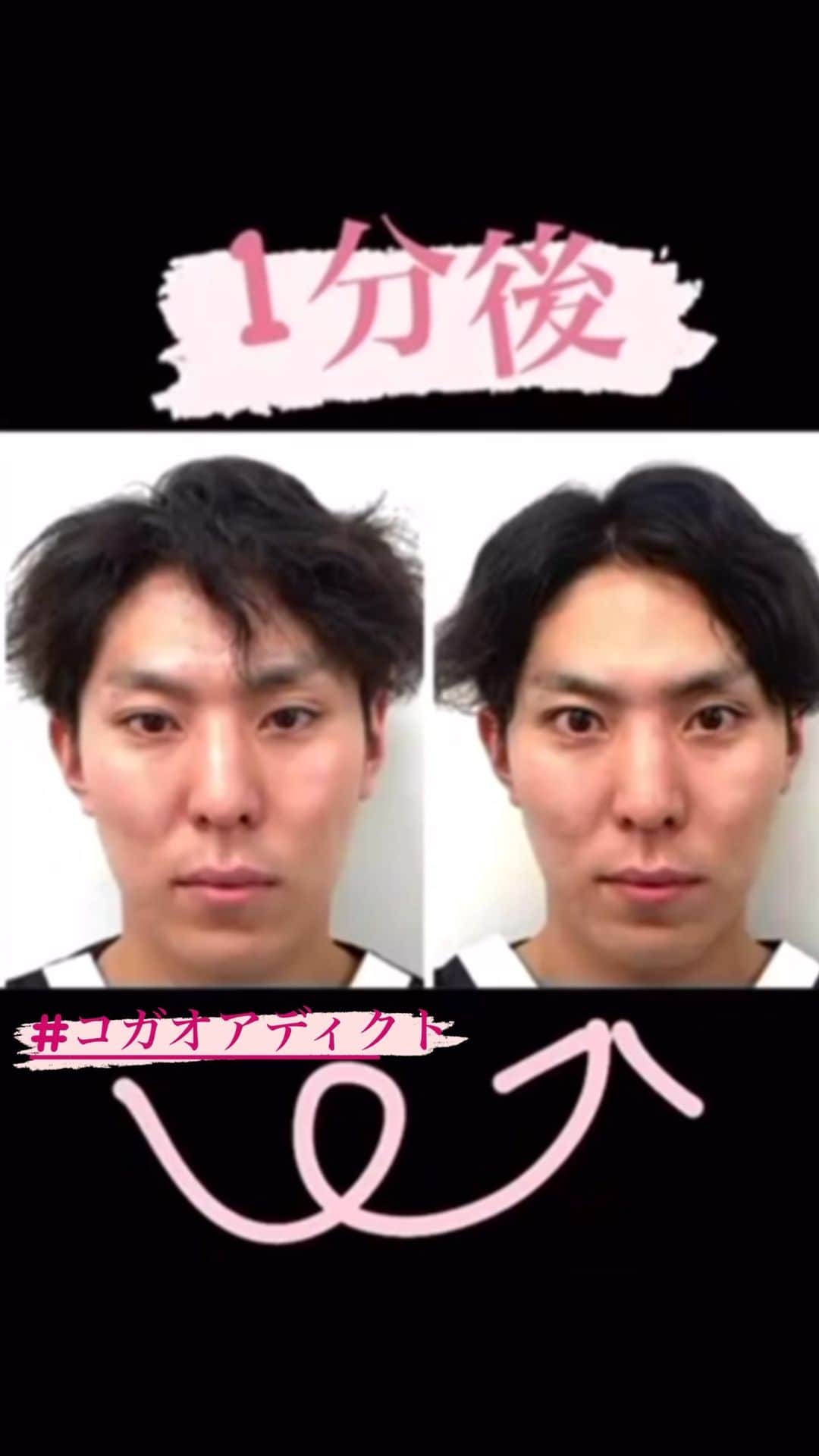 小顔.小顔矯正.Speed小顔公式アカウントのインスタグラム