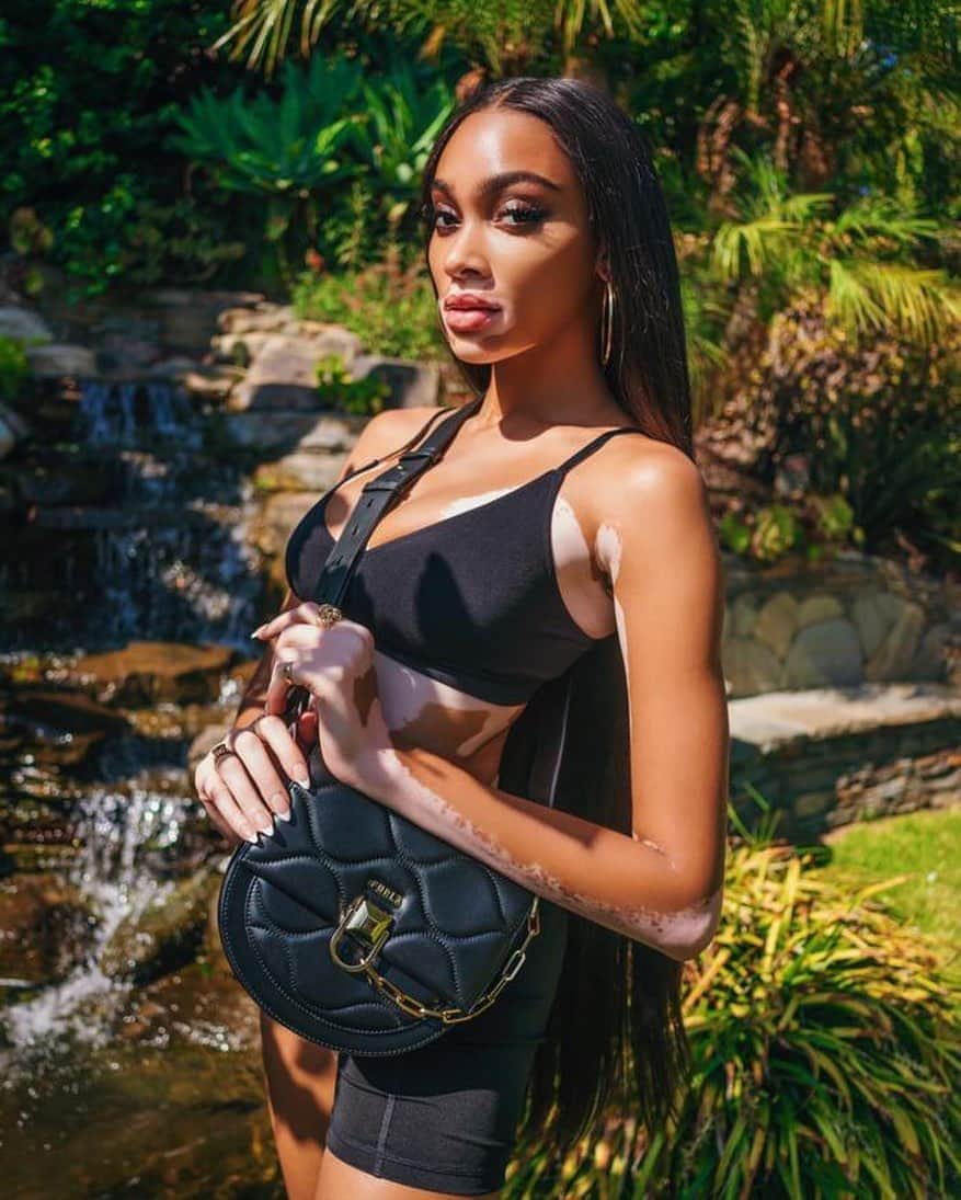 フルラのインスタグラム：「@winnieharlow with her new Furla Miss Mimi, a blend of sharp design and iconic details.   #thefurlasociety #furlafeeling #newcollection #furla #accessories #fashion #furlaopeningparty」