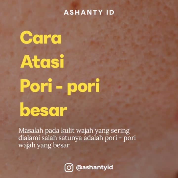ASHANTY BEAUTY CREAM OFFICIALのインスタグラム：「Pori - pori wajah yang besar seringkali mengganggu. Ada beberapa hal yang menyebabkan pori-pori pada wajah menjadi lebih besar. Pertama karena produksi sebum yang berlebihan pada wajah. Penyebab pertama ini terjadi bisa karena makanan yang dikonsumsi, stres, paparan sinar matahari atau pemilihan produk perawatan yang salah,   Penyebab kedua yang membuat pori-pori wajah besar adalah pertambahan usia. Semakin bertambahnya usia maka kulit akan semakin kehilangan elastisitasnya. Berkurangnya elastisitas kulit disebabkan dari produksi kolagen yang melambat atau bisa juga karena paparan sinar matahari.   Cara mengatasi masalah pori - pori yang besar pada kulit wajah, Rutin melakukan double cleansing,  rutin menggunakan day & night cream, hindari menggunakan makeup tebal yang mengakibatkan penyumbatan pada pori - pori wajah dan lakukan  eksfoliasi kulit wajah seminggu sekali 🌸  _____________________________ Informasi dan pemesanan  Ashanty Beauty Cream Chat Via WA : WA: 087778489900 WA: 081293823950 WA: 081287388885 WA: 085781140354 ⚡️ Fast Respons Click Link On Bio Instagram @ashantyid ❣️ ______________________________ #ashantybeautycream #creamashanty #skincareashanty #skincare #skincareartis #skincarelokal #creamwajah #creamperawatanwajah #obatjerawat #jerawat #kosmetik #krimwajah #creamwajah #whiteningcream #ashantyid #ashanty」
