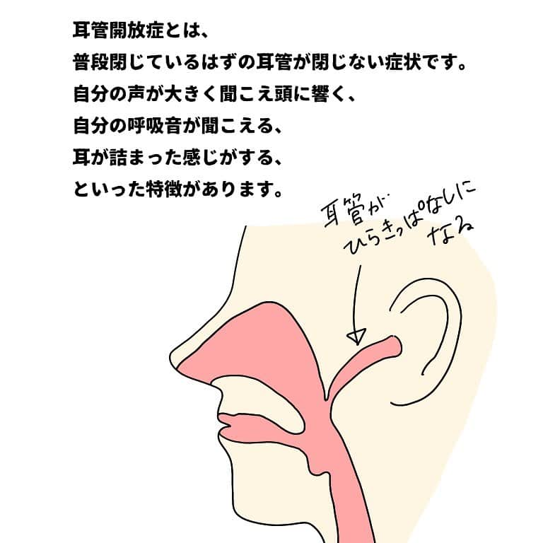 竹内由恵さんのインスタグラム写真 - (竹内由恵Instagram)「この症状は今もひどくなる一方で、悩まされています。同じような症状を経験された方がいたら、ぜひ教えてほしいです😭  #耳管開放症 #あまり知られていない#聞こえないつらさ#なんやねんこれは#ヨシエのヒトリゴト」9月30日 17時04分 - yoshie0takeuchi