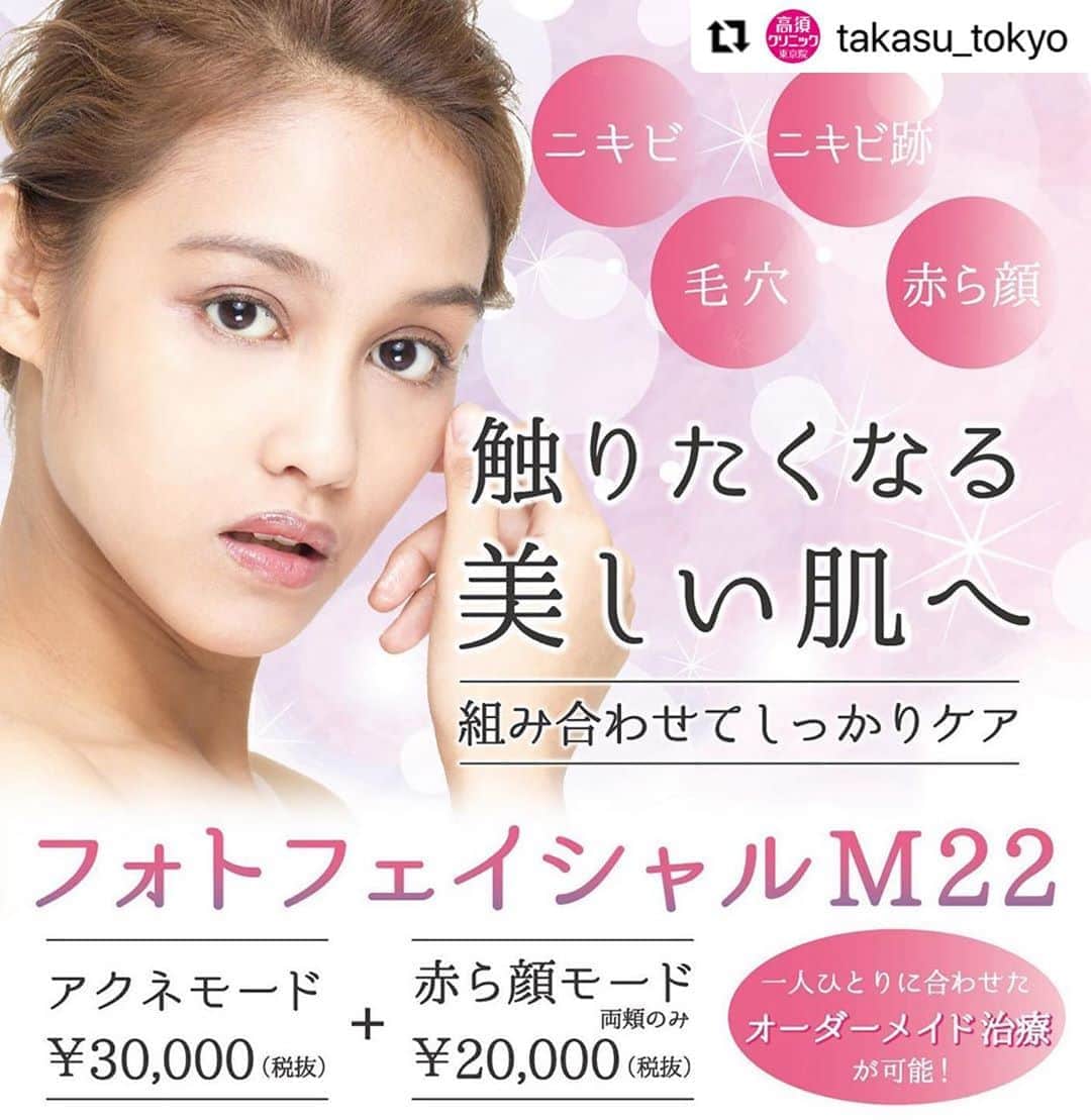 高須クリニックのインスタグラム：「. ━･･━･･━･･━･･━･･━･･━ #Repost @takasu_tokyo ━･･━･･━･･━･･━･･━･･━ コラーゲンの生成を活性化して、シミ、そばかす、くすみ、ニキビ、赤ら顔等の肌悩みを総合的にケアできる「フォトフェイシャルM22」。﻿ 様々な効果の中で最も望んでいる効果を特に発揮できるよう光の波長を変えられるので、一人ひとりに合わせたオーダーメイドの治療ができるのが魅力。﻿ ﻿ 【🌿料金】﻿ ●フォトフェイシャルM22﻿ 顔全体 ￥30,000 （税抜）﻿ 赤ら顔モード 両頬のみ ￥20,000 （税抜）﻿ ［全院］﻿ アクネモード ￥30,000 （税抜）﻿ 肝斑モード ￥30,000 （税抜）﻿ ［東京・横浜・名古屋・栄］﻿ ※フォトフェイシャルM22に加えて、各種イオン導入を施術希望の場合は、イオン導入を通常料金の半額でお受け頂けます。﻿ ﻿ 【⚠️副作用・リスク】﻿ ●フォトフェイシャルM22﻿ 肌のほてり・発赤（照射後／肌が弱い方・敏感肌の方）﻿ ﻿ ﻿ 【ご予約・お問合せ】 ➿0120-5587-10 ※症例写真や施術に関するご質問なども上記までお願い致します。  #高須クリニック　#高須克弥　#美容　#美容整形　#整形　#プチ整形　#整形したい　#美容外科　#美容クリニック　#かわいい　#可愛くなりたい　#綺麗　#綺麗になりたい　#美人　#美容好きな人と繋がりたい　#美容好き　#フォトフェイシャル　#照射治療　#ニキビ跡　#にきび　#ニキビトラブル　#摩擦　#蒸れ　#美肌　#スキンケア　#skincare」
