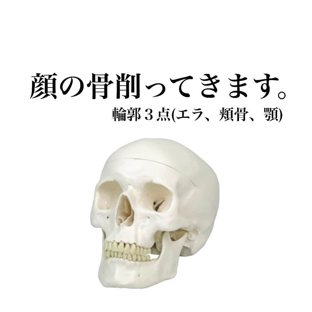 吉川ちかさんのインスタグラム写真 - (吉川ちかInstagram)「10月31日… いよいよ今日骨削ってきます😂💓 緊張し過ぎて怖い… . 今回輪郭３点削ります 頬骨、エラ、顎です‼️ 今まで色んな整形してきたけど 一番怖いし一番大変かもしれない😭💓 . でも可愛くなりたい気持ちが 大きいので、頑張ってきます！！ 絶対に成功しますように…😭🙏💓 . ダウンタイムとかの様子は ストーリーに沢山載せるので チェックして下さいね！！ . #輪郭３点#骨切り手術 #輪郭#コンプレックス#整形#美容整形#頑張ってくる#可愛くなりたい」10月31日 6時13分 - yoshikawachika_1116