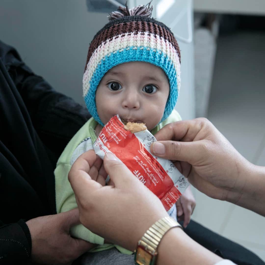unicefさんのインスタグラム写真 - (unicefInstagram)「Seven-month-old Moheb is eating therapeutic food at a UNICEF-supported hospital in Sana'a, Yemen. ⠀ ⠀ As COVID-19 and conflict exacerbate worsening food shortages, 1 in 5 children under five are suffering from acute malnutrition in parts of Yemen.⠀ ⠀ UNICEF is calling for urgent funds to safeguard life-saving nutrition and health services for some of the world's most vulnerable children. © UNICEF/UNI312535/Alghabri」10月27日 15時10分 - unicef