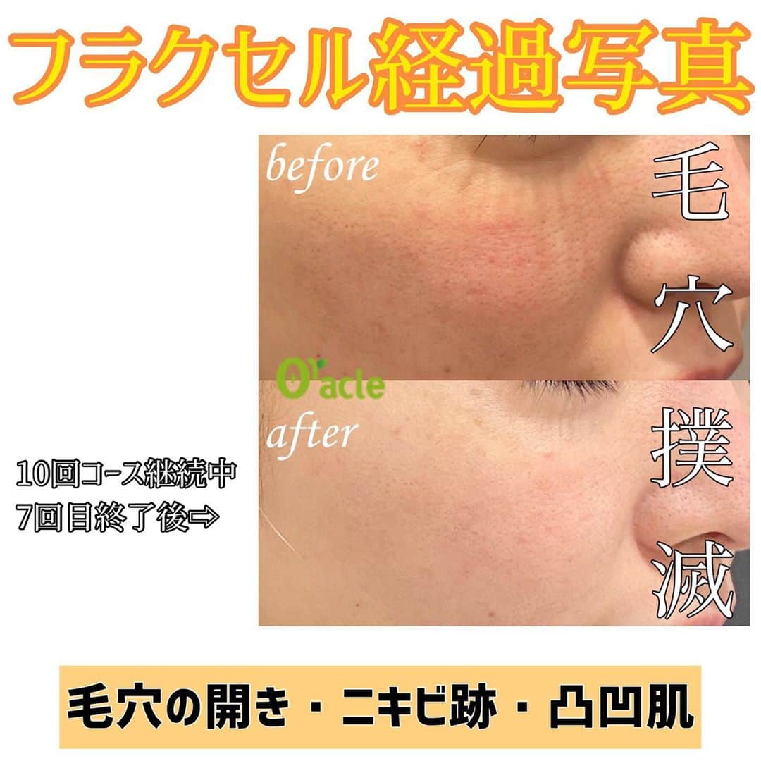オラクル美容皮膚科東京新宿院のインスタグラム