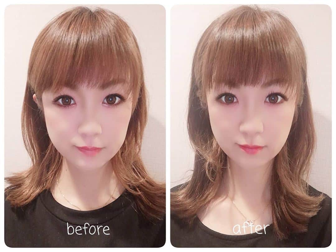 中島彩のインスタグラム：「ハイフ経過❤️ @maison_de_m_misa でハイフを受けてちょうど２週間...✨　 #ビフォーアフター写真  撮ってみました😘 明らかに‼️顔の幅が狭くなってる😍顔がきゅっとしたからか、目も大きくなった気が？する‼️ (なるべく分かりやすいように状況近付けましたが、全く同じにはできなかった..💦) この効果に感動しちゃって❤️ 急いで２回目の予約も入れました😎💕 続けて受けると効果もより分かりやすいとのことで期待高まる💕  #ハイフ　#アンチエイジング　#エイジングケア #ビフォアフ　#ハイフエステ #ビフォアフ写真 #ビフォーアフター」
