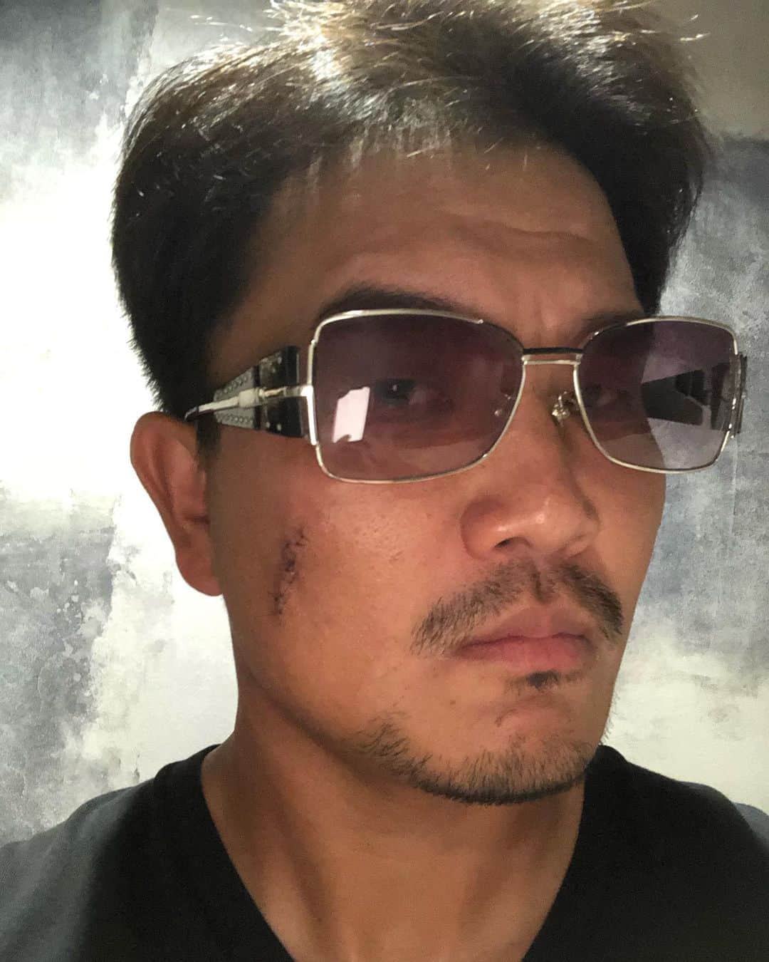 大西宏明のインスタグラム：「顔の傷🩹 せっかくなんで記念にこんな写真🕶撮っておきました😂  ついでに昔のヤクザ役も📺😆  #記念撮影 #強面 #傷顔 #サングラス #吉本新喜劇  #ヤクザ  #舞台 #甲子園　より #緊張　した #smile #ほなっ！！」