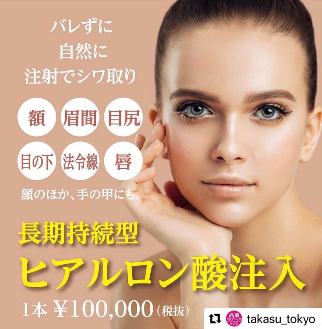高須クリニックのインスタグラム：「. ━･･━･･━･･━･･━･･━･･━ #Repost @takasu_tokyo ━･･━･･━･･━･･━･･━･･━ 今や定番となったプチ整形の代表選手・注射式しわ取り。﻿ 「メイクを変えた？」と聞かれるほど、さり気ない仕上がりは、「バレずにきれいになりたい」という女性にも心強い味方です。﻿ ﻿ 【🌿料金】﻿ ●注射式シワ取り 長期持続型ヒアルロン酸注入﻿ 1本¥100,000（税抜）［全院］﻿ ﻿ 【⚠️副作用・リスク】﻿ ●注射式シワ取り 長期持続型ヒアルロン酸注入﻿ 内出血（注射針が血管に当たってしまった場合）、仕上がりのわずかな左右差（完璧なシンメトリーは不可）、アレルギーが生じる可能性、注入後の感染、血流不全、皮膚壊死、過度にいじったり揉んだりすると腫れる可能性﻿ ﻿ ﻿ 【ご予約・お問合せ】 ➿0120-5587-10 ※症例写真や施術に関するご質問なども上記までお願い致します。  #高須クリニック　#高須克弥　#美容　#美容整形　#整形手術　#整形　#プチ整形　#整形したい　#美容外科　#美容クリニック　#かわいい　#可愛くなりたい　#綺麗　#綺麗になりたい　#美人　#美容好きな人と繋がりたい　#美容好き　#美肌　#エイジングケア　#シワ取り　#注射　#ヒアルロン酸　#ヒアルロン酸注射　#ヒアルロン酸注入　#シワ　#くぼみ目　#目の下のクマ　#wrinkle　#agingcare」