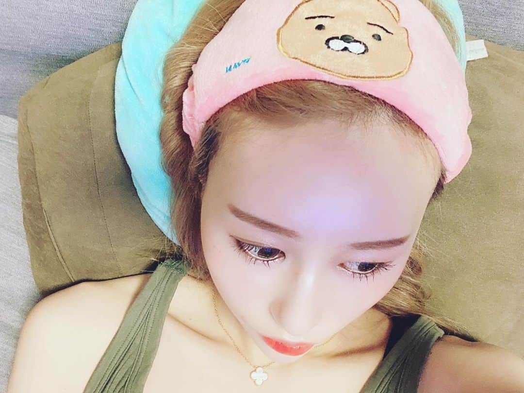 のインスタグラム：「. おでこのぷるぷる注射【prp注射】から何ヶ月か経ってちゃんと丸くなった😚💕 ダウンタイム中のパンパンな顔が懐かしい🤣 最近経過見せに行った時にエラのボトックスと顎とクマにもぷるぷる注射してもらったよ✌︎ ヒアルロン酸だとすぐに吸収しちゃうからこっちの方がおすすめ😋 . #プルージュ美容クリニック　#ぷるぷる注射　#prp #おでこ　#ボトックス　#プチ整形　#✌︎」