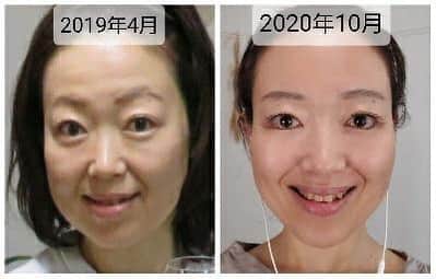 間々田佳子さんのインスタグラム写真 - (間々田佳子Instagram)「顔もカラダと同じ筋肉 いくつになっても答えてくれる‼️  毎日 少し頬に意識を向けるだけでも顔の形は変わる  大阪のまみさんです。 先日コアフェイストレーニングのジュニアインストラクターになりました！  レッスンもしていますよ！  #コアフェイストレーニング  #コアフェイストレーニングジュニアインストラクター」10月9日 16時23分 - yoshiko.mamada