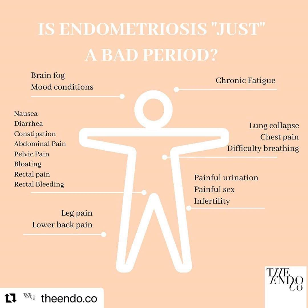 マデリン・グローヴスさんのインスタグラム写真 - (マデリン・グローヴスInstagram)「#Repost @theendo.co with @make_repost ・・・ A common misconception about endometriosis is that it “only”presents as period pain or bad cramps. This could not be further from the truth! Endometriosis is a full body disease that can affect many different systems within the body.  For more information to gain a better understanding of endo, visit our website for a list of trusted resources.」10月10日 12時27分 - mad_groves