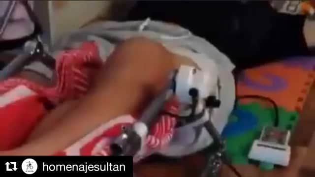 エルキン・ソトのインスタグラム：「#Repost @homenajesultan with @get_repost ・・・ Conoce un poco sobre el proceso de rehabilitación de nuestro ídolo manizaleño Elkin Soto. . . .  #esfuerzo #homenajealsultán #16 #rehabilitacion #mainz05 #05 #elsultán」