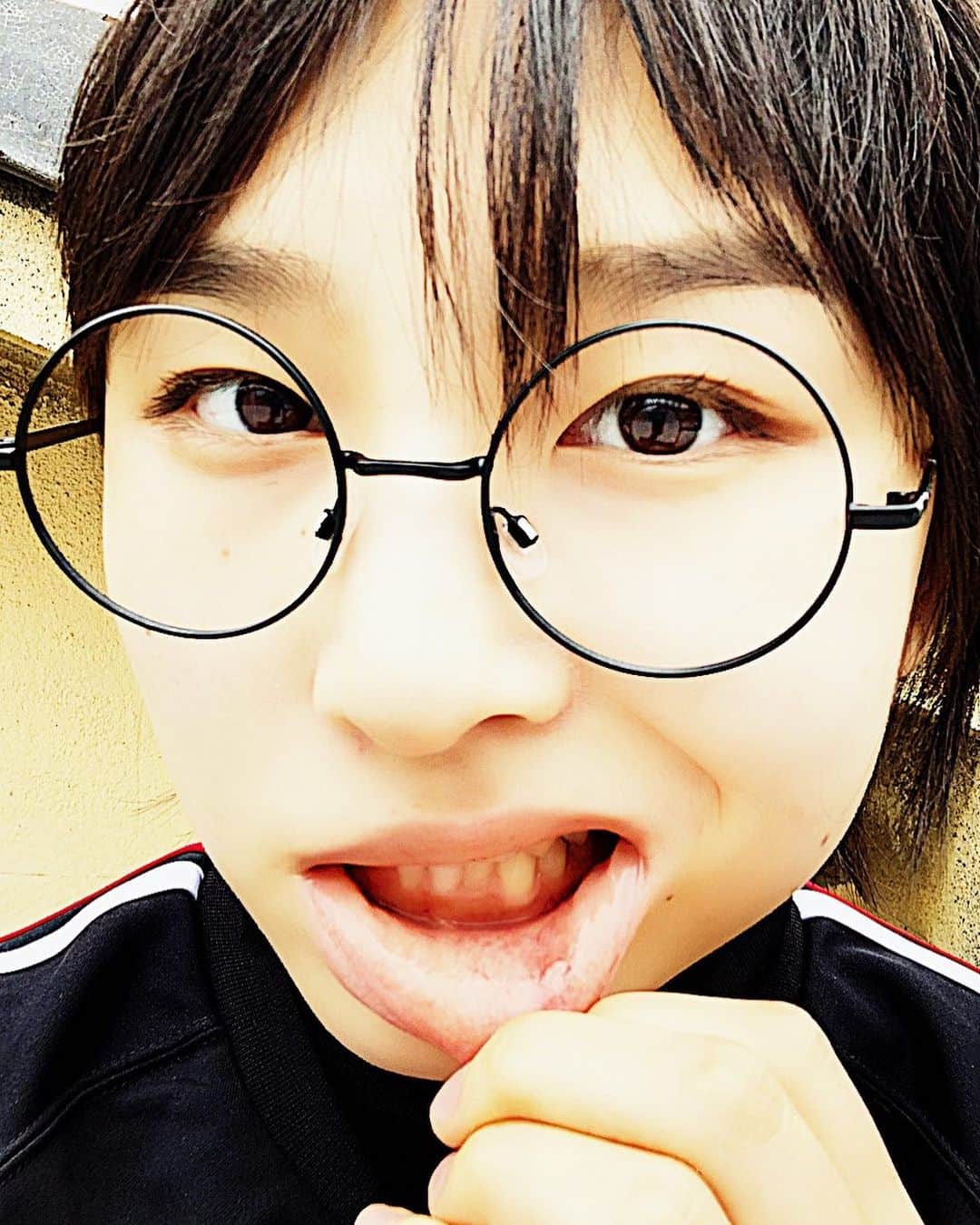 SUZUKAさんのインスタグラム写真 - (SUZUKAInstagram)「口内炎なう」10月11日 16時37分 - suzuka_leaders