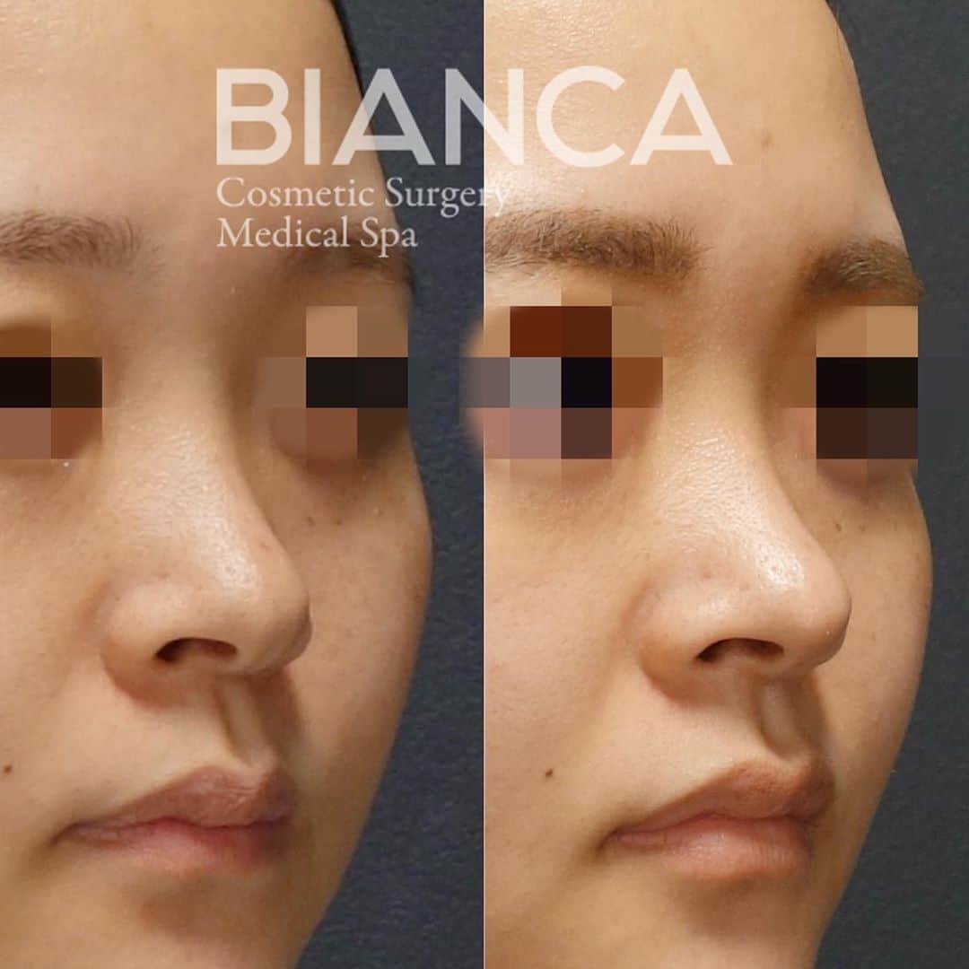 辻沢由有（BIANCA CLNIC 表参道院 院長）のインスタグラム