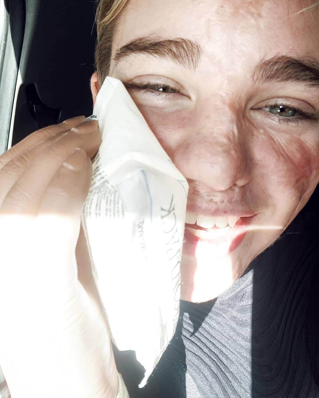 ベアトリーチェ・ヴィオのインスタグラム：「Ho ciolcio il dencie del giugicio...levalo anche ciu 🤣🦷 Qualche rimedio per farmi tornare normale? 🤕」