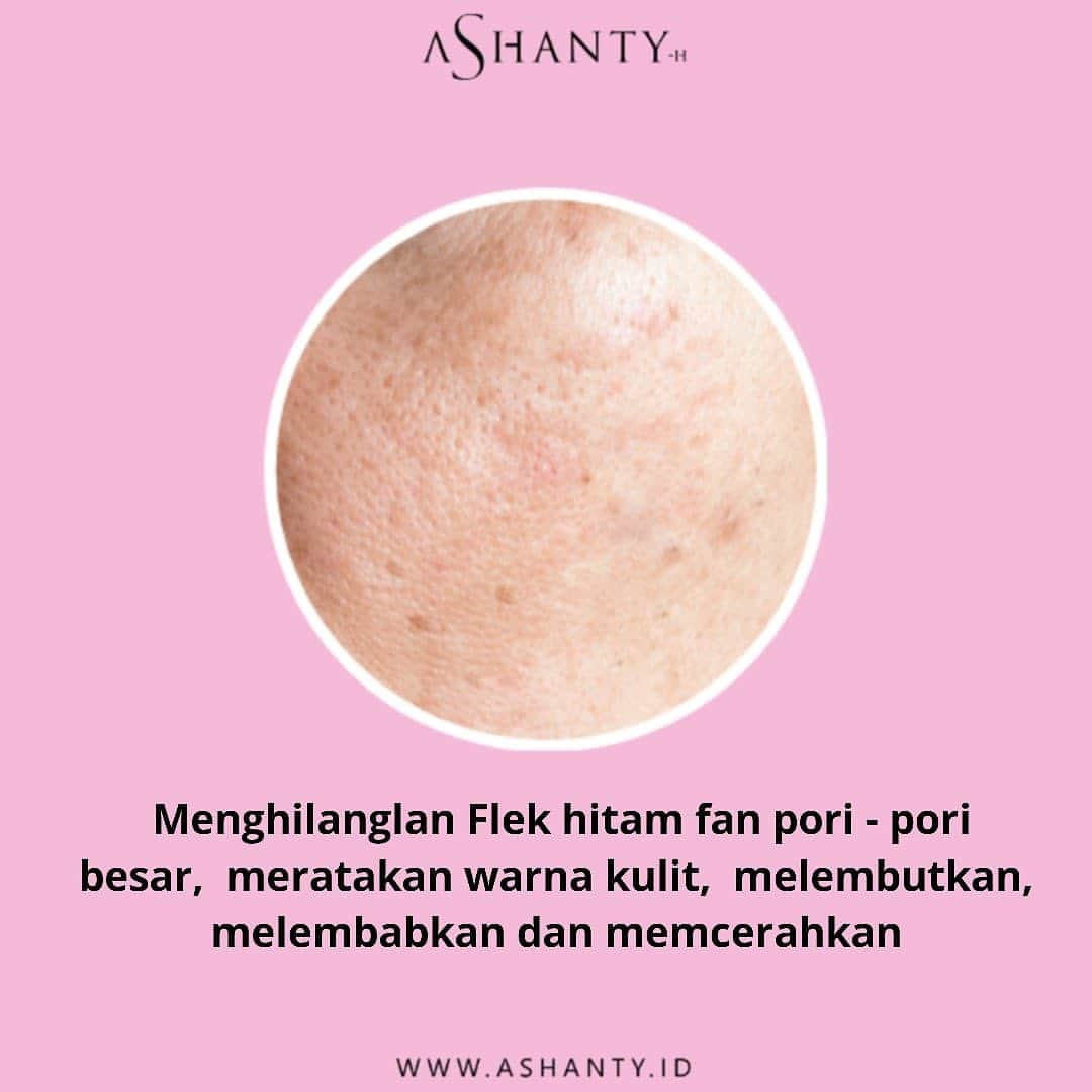 ASHANTY BEAUTY CREAM OFFICIALさんのインスタグラム写真 - (ASHANTY BEAUTY CREAM OFFICIALInstagram)「Kulit wajah yang sehat, cerah, kencang dan kenyal diusia yang tidak lagi muda tentunya impian setiap wanita, sebelum terlambat mulailah merawat wajah dengan menggunakan cream perawatan wajah yang sudah mengandung anti aging. Banyak sekali faktor yang dapat mengakibatkan timbulnya tanda penuaan dini, cegah dari sekarang sebelum terlambat! Anti Aging Cream Series by Ashanty adalah pilihan yang tepat untuk merawat dan menutrisi kulit wajah 🌸✨  _____________________________ Informasi dan pemesanan  Ashanty Beauty Cream Chat Via WA : WA: 081287388885 WA: 085781140354 WA: 087778489900 WA: 081293823950 ⚡️ Fast Respons Click Link On Bio Instagram @ashantyid ❣️ ______________________________ #ashantybeautycream #creamashanty #skincareashanty #skincare #skincareartis #skincarelokal #creamwajah #creamperawatanwajah #obatjerawat #jerawat #kosmetik #krimwajah #creamwajah #whiteningcream #ashantyid #ashanty」10月14日 10時01分 - ashanty.store