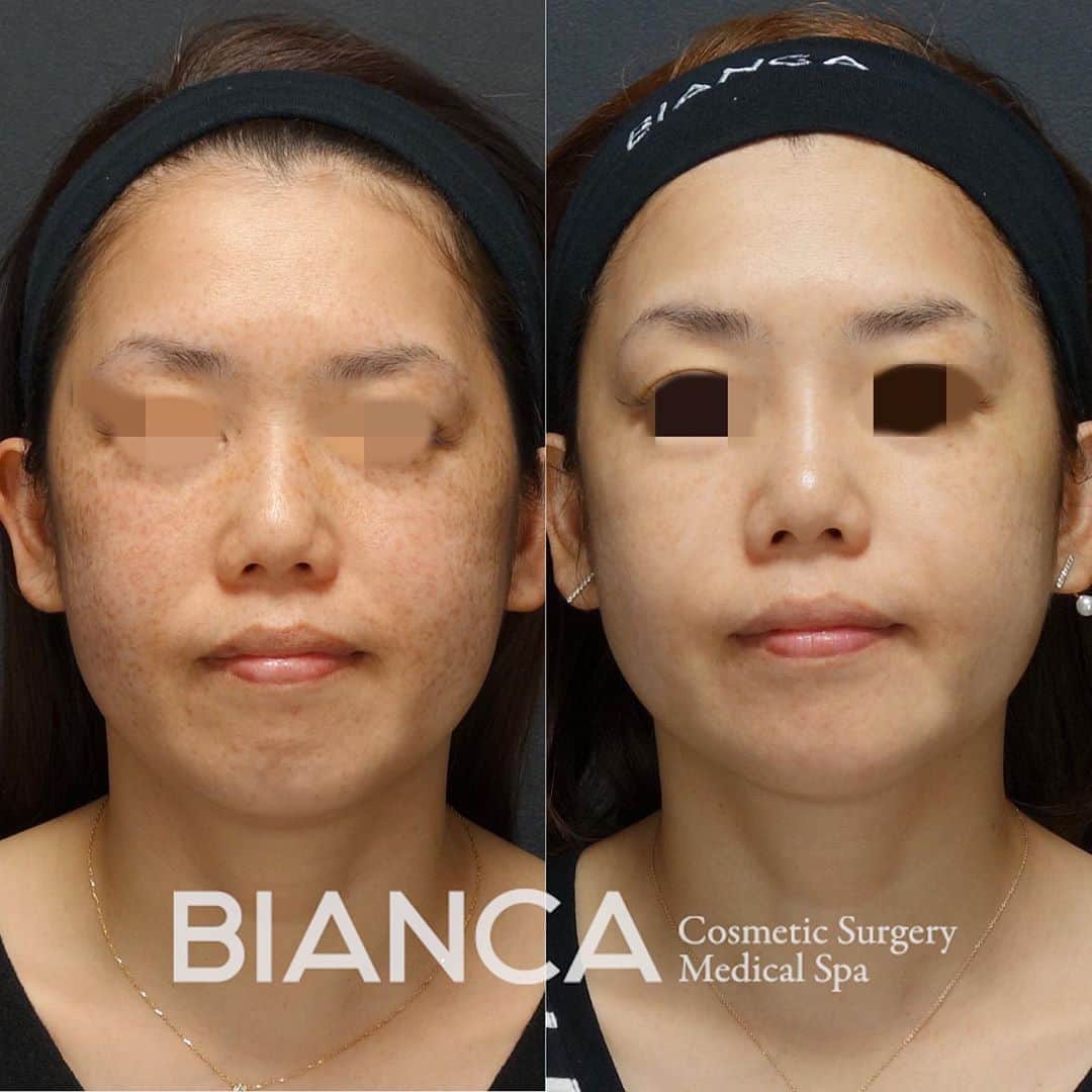 辻沢由有（BIANCA CLNIC 表参道院 院長）のインスタグラム
