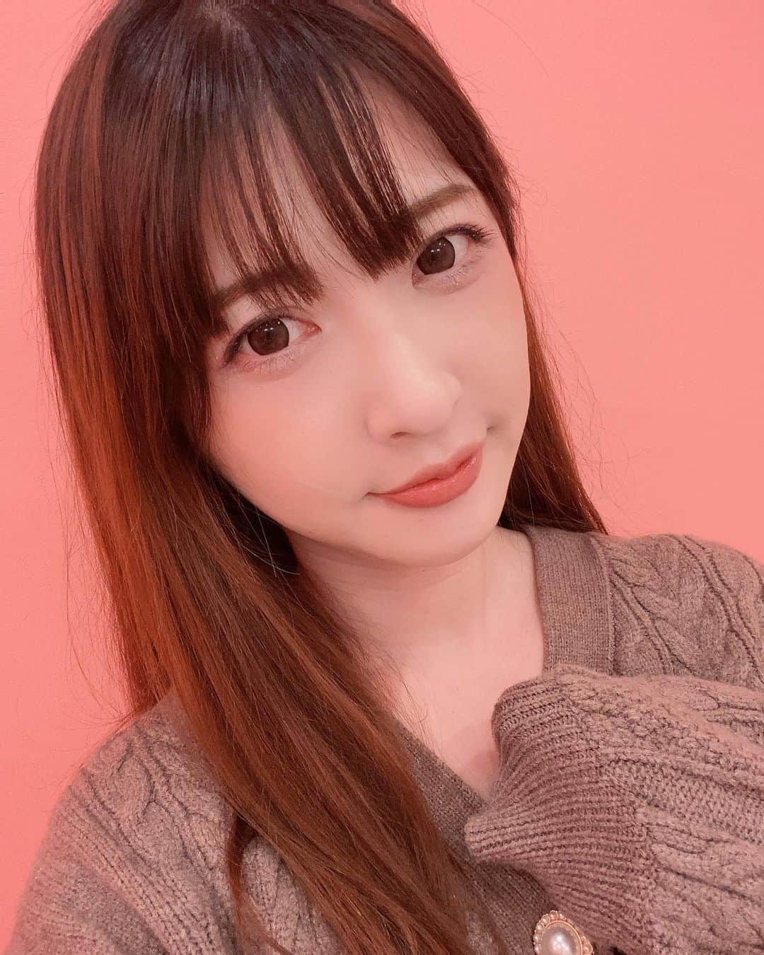 のインスタグラム：「今日、#aclinic で #山田哲雄 先生 @a_clinic_ginza にAスレッドを施術してもらいました！  大満足！めっっちゃスッキリしました～！！ビフォーアフターのスワイプして見てみて🥺💓  #コロナ太り の影響で顎のもたつきとか、#ほうれい線 がとても気になっていたので行ってきました！  とにかく頬が上がったし、顎肉も上がった影響か気にならなくなりました😭✨しかも小顔になった…わかる…？  笑気麻酔をしてもらったのでぼんやりしていて痛みもなかったよ！ ぜんぜん腫れたりもしていないです！  先生も声かけてくれて、看護師さんもがんばってくださいねーと優しくてあっという間でした。とっても親切で丁寧でした！ クリニックも待合室とか綺麗でかわいくて住みたいなと思ったよ 笑  半年から1年くらい効果が持続するらしい。またやりたい！！他にもリップとか、目の上のたるみ取りとかバッカルファット除去とか気になるな…！  山田先生と写真も撮ってもらいました✨  #aスレッド #aclinic #aclinic銀座 #aclinic横浜 #aクリニック #美容 #小顔 #美肌 #リフトアップ #美容外科 #美容皮膚科 #美容クリニック #山田哲雄」
