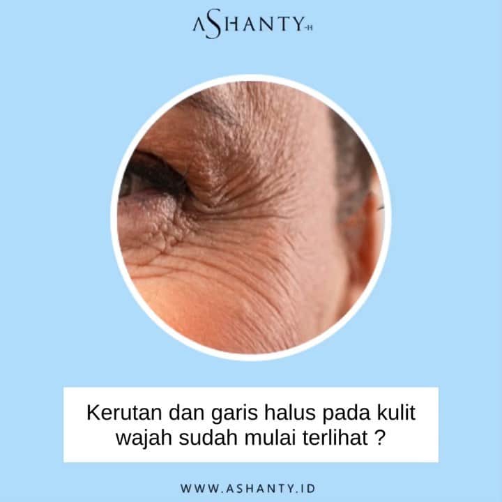 ASHANTY BEAUTY CREAM OFFICIALのインスタグラム：「Tanda penuaan dini pada kulit wajah sudah mulai muncul dan membuat resah ? Tidak perlu khawatir, cegah timbulnya tanda penuaan dini dari sekarang menggunakan Ashanty Beauty Cream Anti Aging Series. Merawat dan menutrisi kulit wajah secara maksimal, membuat wajah terlihat lebih sehat, cerah berseri, glowing, lembut, lembab, kencang, kenyal dan pastinya terbebas dari tanda penuaaan dini seperti kerutan, flek hitam, pori - pori besar dan garis halus 😍  _____________________________ Informasi dan pemesanan  Ashanty Beauty Cream Chat Via WA : WA: 081287388885 WA: 085781140354 WA: 087778489900 WA: 081293823950 ⚡️ Fast Respons Click Link On Bio Instagram @ashantyid ❣️ ______________________________ #ashantybeautycream #creamashanty #skincareashanty #skincare #skincareartis #skincarelokal #creamwajah #creamperawatanwajah #obatjerawat #jerawat #kosmetik #krimwajah #creamwajah #whiteningcream #ashantyid #ashanty」