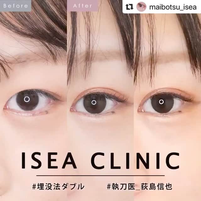 東京イセアクリニックのインスタグラム