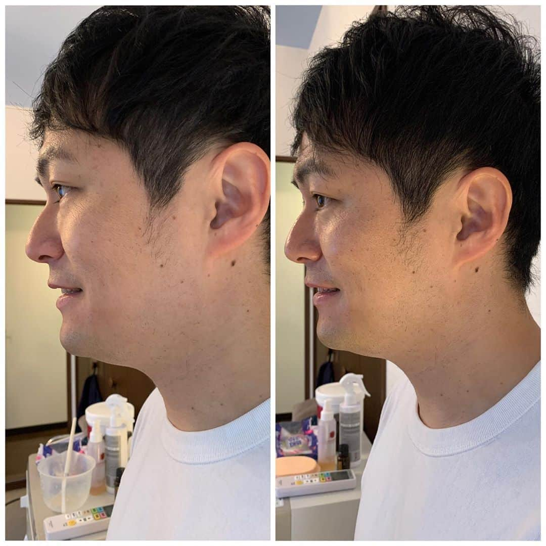 梅村賢太郎さんのインスタグラム写真 - (梅村賢太郎Instagram)「3枚あります #ミミ #エステ #小顔 #左before #右after #60分 #とろけるエステ #顔 #デコルテ #肩 #ヘッドマッサージ #梅割り #初回 #50%OFF #大サービスです #詳しくは #タグのアカウントまで #DM を #女性限定 #ラフ次元 #梅村」10月31日 12時18分 - rahujigenume