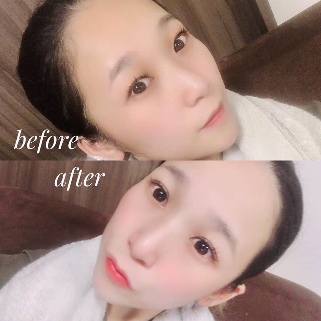 のインスタグラム：「I got a double eyelid👁✨✨ I was able to make it clear and beautiful💓 I'm glad that my eyes look big(*☻-☻*)✨✨ @girls.maker  ひさびさにふたえになれたよー✨ 強力だから思い通りのラインになって満足( ^ω^ ) 汗や水にも強い！ キレイな二重を一日キープできる強力さを持ってるねー💗 顔が甘くなった気がするww どうー？w 夜な夜な盛り上がってますww #ガールズメーカー﻿ #エタニティライン﻿ #二重メイク」
