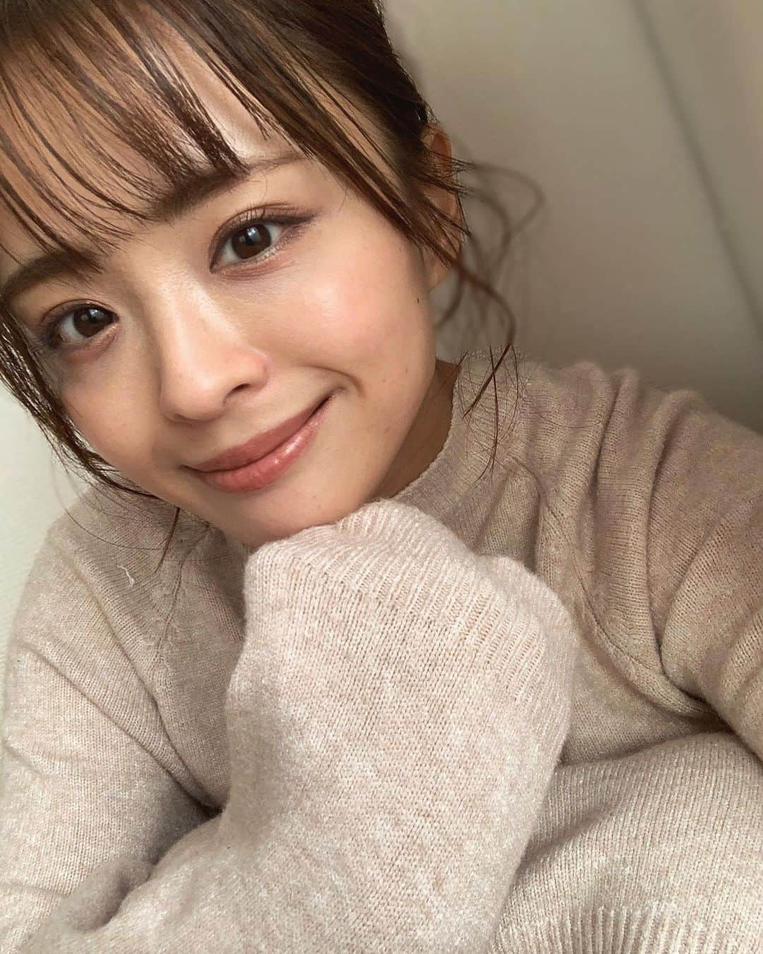 千葉優子さんのインスタグラム写真 - (千葉優子Instagram)「. . ストーリーではちらっと載せて たくさんの方からメッセージ頂いたんだけど🙏  9月初めの方に @pruge_clinic さんで #ぷるぷる注射　を受けてきました❤︎ 少し載せただけなんだけど 本当に色んな方からメッセージ貰って それをきっかけに何名か実際にやってくれた方も😳❤︎‼︎ ありがとうございます❤︎  小学校の頃からずーーっとコンプレックスで 隠そうと頑張ってきた私の頑固なクマ。 (大きな声では言えないけど、中1からすっぴんで学校に行った事がないくらい) 昔皮膚科とかにも通って美白クリームとか 漢方とかも試したんだけど治らなくて😢 どうやら骨格による影クマ&色素沈着の合わせ技らしい🤣 だから色補正の下地とコンシーラー2色で 隠そうとしてきたんだけどやっぱり消えず… 疲れてないのに疲れて見える事が多かったの！  色んな方の投稿で気になってた#PRP は 自分の血液を使った再生治療で メスを入れず注射をするだけ💉  まず @dr_okamoto 先生に診察をして貰って 採血してメイクを落として塗る麻酔を。 施術室でマーキングをして部分麻酔をして注射。  3枚目の動画みたいにやっていくんだけど 私は痛みにそんなに強いわけではないんだけど 施術中は先生とずーっと笑顔で 話せてたくらいのレベルだったなあ。 (あ、ちなみに欲張ってほうれい線もお願いした🙏笑) 最後に先生が形を整えて終わり❤︎  4枚目が施術直後！ 私顔がすっごく赤くなりやすい体質だから 結構赤くなったけど💦 これは教えて貰ってた通り1.5時間くらいでひいた！ 直後から何十年の悩みがなくなったことに ものすごい感動したよ…🥺  みんなが気になるダウンタイムは 周りの人に聞いたら全く腫れない人もいたし むくみ程度に腫れる人もいたんだけど、 私は腫れた方だと思うな〜 けど笑うと違和感があるくらいだったよ〜‼︎ マスクで隠れたから良かった❤︎  4日目がピークであっという間に治ったよ👏 (1週間後にはもう七五三の写真撮ってた‼︎)  そしてPRPは再生治療だから 40〜50日で効果がマックスになるんだけど 今ちょうど40日経ちました！ 2枚目が昨日撮ったもので顔の加工は一切なし‼ ︎(インカメで撮って背景をちょっとぼかしてるだけ)  まずね、施術直後から目の下の凹みが全くなくなって ものすごく感動したの。 あんなに悩んできたのが嘘みたい🤣 影クマは本当に一切気にしなくて良くなった‼︎ 色素沈着も薄くなったのを実感してて 下地＋コンシーラー2種類使ってたけど 今は1種類だけを軽く塗れば良くなって とにかく時短になって助かってるし嬉しい😭‼︎  私よりクマが酷い人ってあんまり見た事がないから笑 ほとんどの人はかなり改善されるんじゃないかなと思います🥺❤︎  私は本当にやって良かったとしか思わない‼︎ 私と同じように悩んでる方、 赤羽の @pruge_clinic にぜひ相談してみて下さい☺ 先生もスタッフさんもみんな優しくて 相談しやすいよ〜☺❤︎  #プルージュ美容クリニック#美容#美容好きな人と繋がりたい#アラサー女子#アラサーママ#アラサー美容#美容#美容好きな人と繋がりたい#アラサー女子#体験レポ#pr」10月17日 10時51分 - yuko_chiba1018