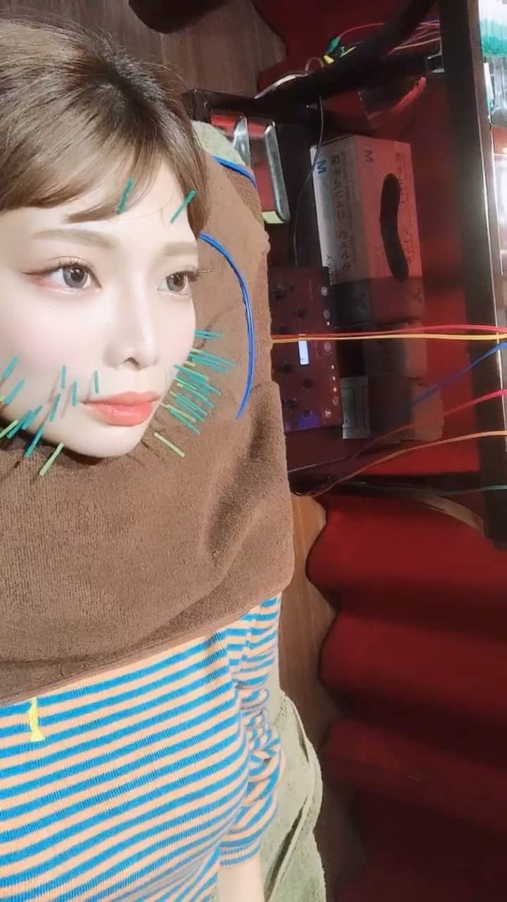 のインスタグラム：「アンドロイド、修理中🤖🔧 . . 1ヶ月に1回メンテナンスしてもらってます！ エラが張ってるからエラで噛まずに違う筋肉に噛めるようにしてもらえた時は、ほんとに神業だと思いました。美容鍼界のカリスマ杉崎先生 @sugizakikenya いつもお世話になってます！ . . #美容鍼 #きゅきゅっと美容鍼 #美容鍼灸 #美容鍼灸サロン #鍼灸 #鍼灸院 #笹塚 #美容 #美容垢 #美容マニア #美容大好き #美容好き #美容オタク #美容鍼灸 #美活 #美活 #綺麗になりたい #敏感肌 #ニキビケア #リフトアップ #たるみ改善 #たるみ #ほうれい線 #リール #japan #japanese #beauty #beautycare #love #like #follow」
