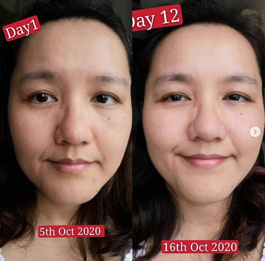 Motives Cosmeticsさんのインスタグラム写真 - (Motives CosmeticsInstagram)「👏ROUND OF APPLAUSE 👏For all of you who are crushing it with our #28DAYSOFSKIN Challenge!  It is never too late to join in! Find a skincare regimen suited for your skin's needs & start caring for your skin daily. Be sure to snap a before picture so we can see your amazing results & tag us on IG with the official challenge hashtag  #28DAYSOFSKIN.  Tap our "28 Day Of Skin" highlight to learn more.  . . . . . #lumieredevie #skincare #skinisin #beauty #naturalskin #naturalbeauty #lumiere #LDV #glowingskin #skincaretip #skintip #healthyskin #skincareroutine #skinroutine #motivescosmetics #skincarechallenge」10月18日 4時00分 - motivescosmetics