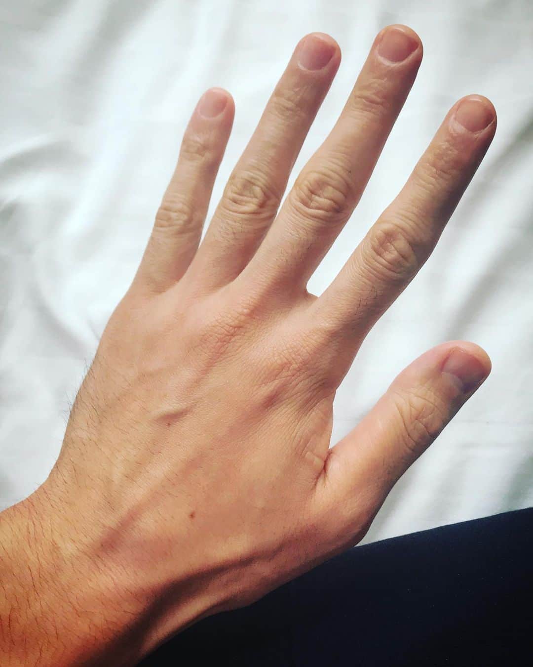 藤井裕史のインスタグラム：「My #hand」