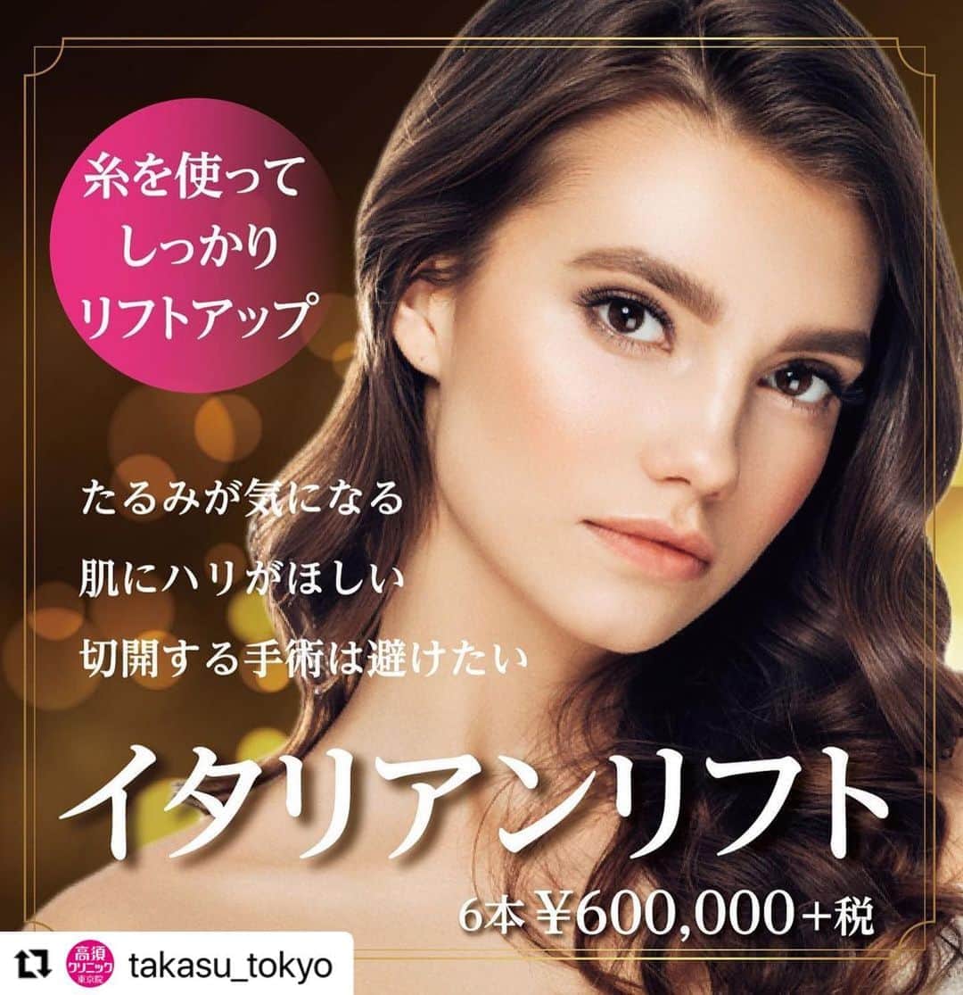 高須クリニックのインスタグラム：「. ━･･━･･━･･━･･━･･━･･━ #Repost @takasu_tokyo ━･･━･･━･･━･･━･･━･･━ 糸を皮下に埋め込んで、皮膚を引き上げることで顔や首にできたしわ・たるみを改善する「イタリアンリフト」。﻿ 糸は時間の経過とともに自分の組織の一部に変わり、半永久的に美しさを保ち続けます。﻿ メスを使う手術には抵抗があるという方に。﻿ ﻿ 【🌿料金】﻿ ●イタリアンリフト﻿ 1本¥100,000（税抜）﻿ 6本¥600,000（税抜）﻿ ［全院］﻿ ﻿ 【⚠️副作用・リスク】﻿ ●イタリアンリフト﻿ 麻酔による腫れ・内出血（術後）﻿ ﻿ 【ご予約・お問合せ】 ➿0120-5587-10 ※症例写真や施術に関するご質問なども上記までお願い致します。  #高須クリニック　#高須克弥　#美容　#美容整形　#整形　#プチ整形　#整形したい　#美容外科　#美容クリニック　#かわいい　#可愛くなりたい　#綺麗　#綺麗になりたい　#美人　#美容好きな人と繋がりたい　#美容好き　#たるみ　#シワ　#フェイスライン　#イタリアンリフト　#糸のリフト　#リフトアップ　#エイジングケア　#自分へのご褒美　#整形手術」