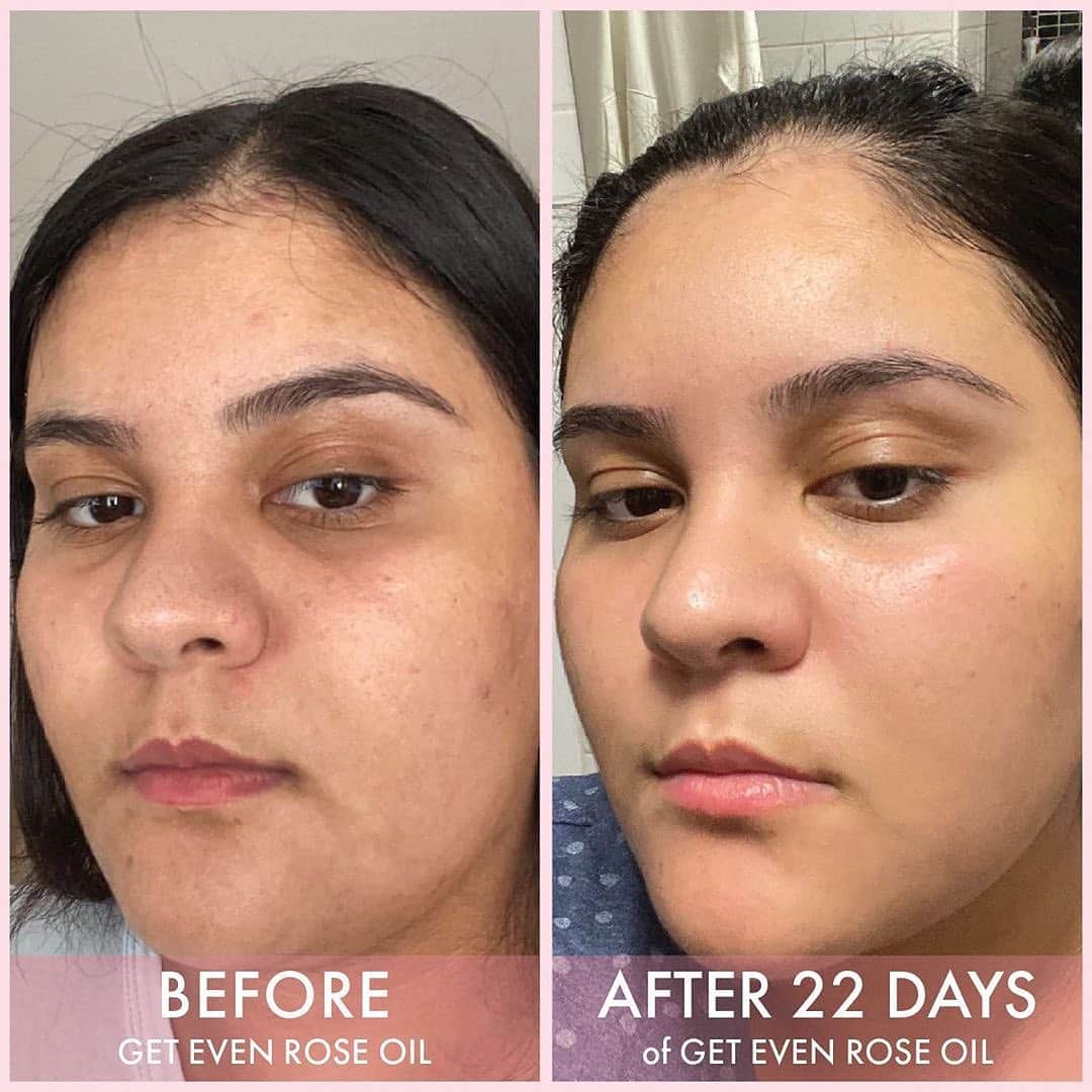 Huda Kattanさんのインスタグラム写真 - (Huda KattanInstagram)「repost @wishfulskin  These results made my whole team so happy! You touched us in so many ways! Thank you for sharing your beautiful results! 😱😱@souhailalaghmiri @souhailalaghmiri @souhailalaghmiri Congratulations on winning the entire #WishfulSkinRoutine my love!! 😘😘😘 Share with us (tag or DM) your before & afters for the chance to be the next winner! Stay safe & love you all so much」10月20日 2時12分 - hudabeauty