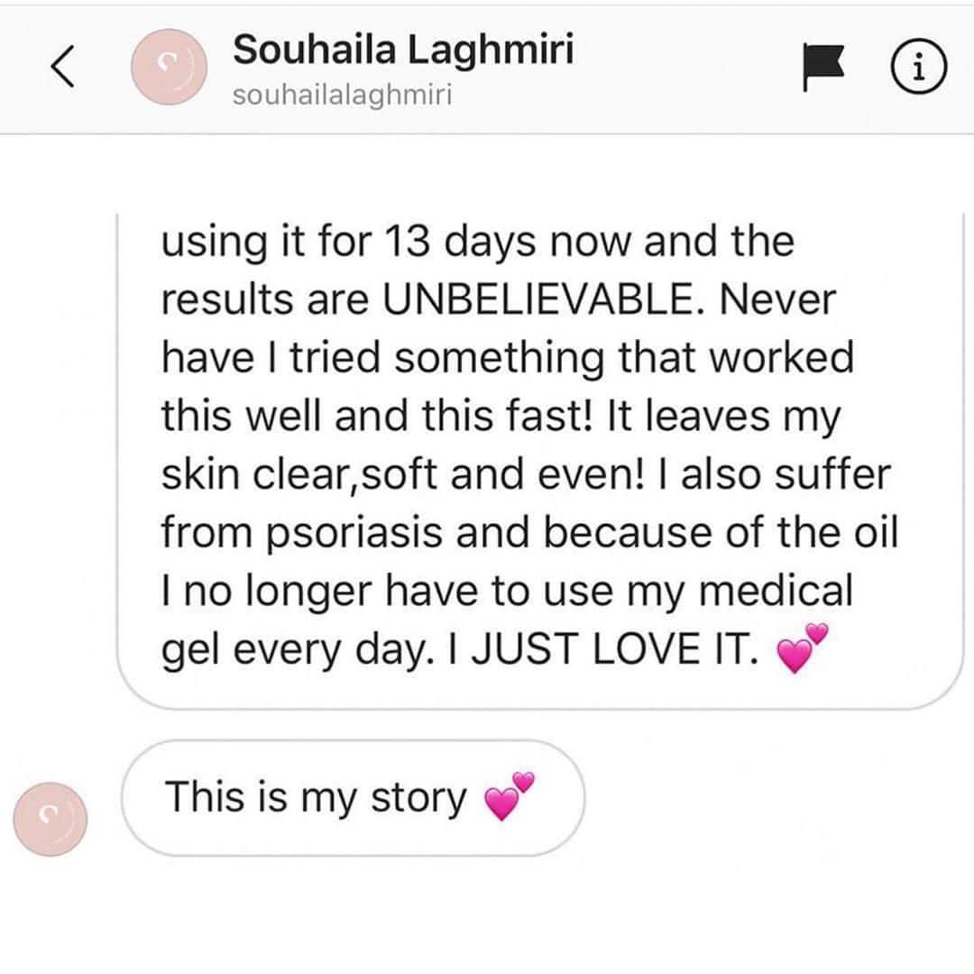 Huda Kattanさんのインスタグラム写真 - (Huda KattanInstagram)「repost @wishfulskin  These results made my whole team so happy! You touched us in so many ways! Thank you for sharing your beautiful results! 😱😱@souhailalaghmiri @souhailalaghmiri @souhailalaghmiri Congratulations on winning the entire #WishfulSkinRoutine my love!! 😘😘😘 Share with us (tag or DM) your before & afters for the chance to be the next winner! Stay safe & love you all so much」10月20日 2時12分 - hudabeauty