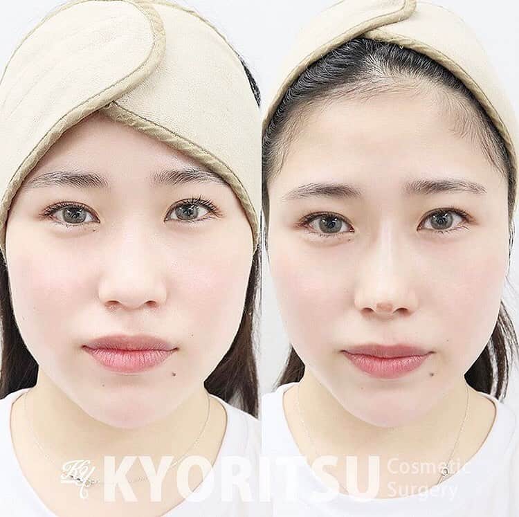 共立美容外科・歯科・皮膚科のインスタグラム