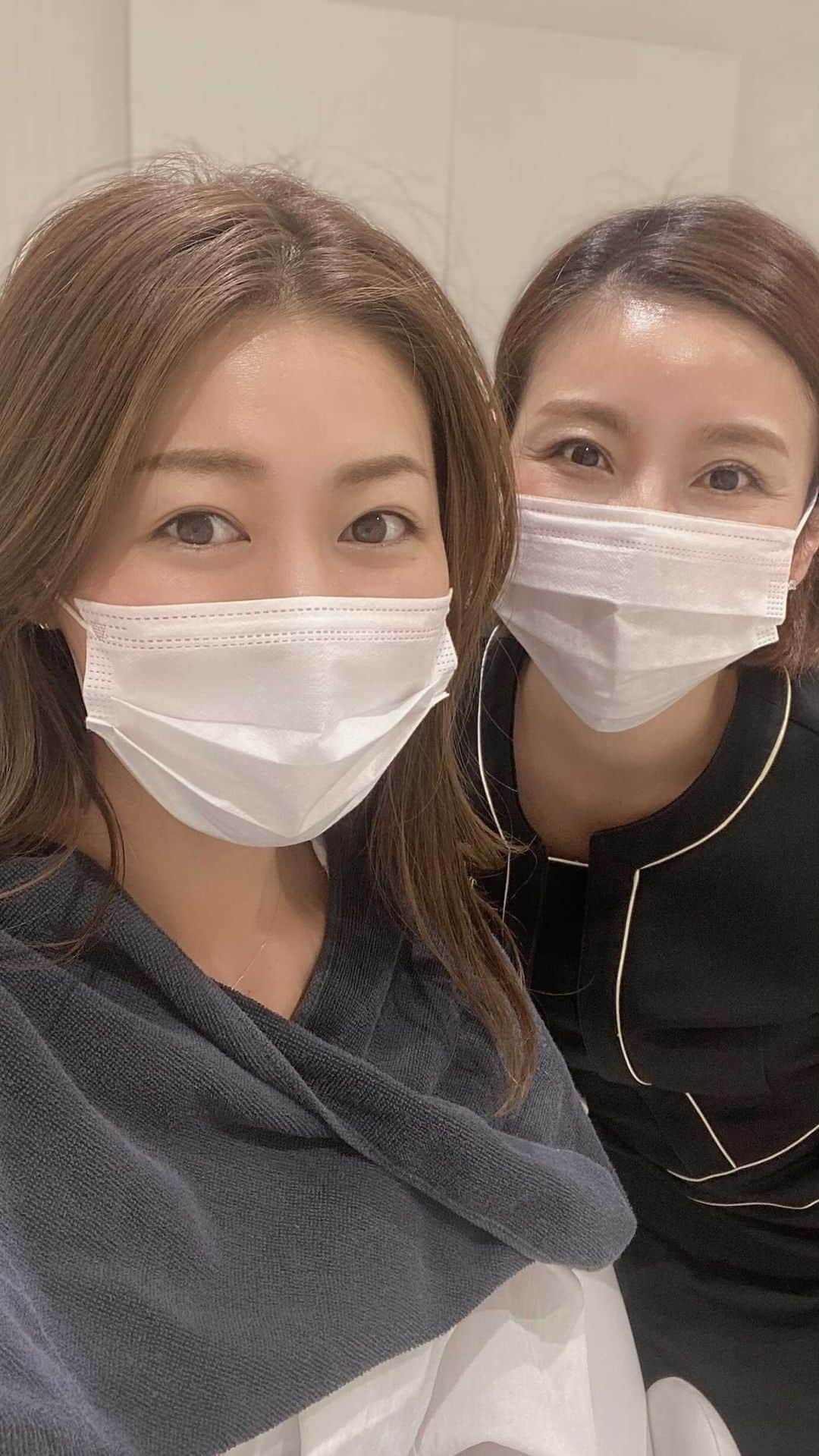 のインスタグラム：「こんにちは♪ 『眉毛について』 いろんな方から聞かれるのでお答えします⭐︎  2年くらい前に眉毛のアートメイクをして頂いて、 それからはほぼ描かなくても眉毛のある生活を送ってます♪笑  2回ほど @mesm_medical_skin_make に通えば 4年ほどはこのままの状態をキープできて、 人によるとは思うのですが私は今も綺麗に残ってくれてます♪  施術をしてくれる @tokyo_hills_clinic の @thc_miho.k  みほ先生は優しいのに人生経験豊富で。笑  お話ししててとても楽しい♪ また、会いたくて次はアートメイクでアイラインを入れてもらいました⭐︎  動画を見てくれた人は分かるかな⁇ まつ毛とまつ毛の間を埋めるように綺麗に入れてくれるからまつ毛がふさふさして見えて、  すっぴんでもアイラインが浮かないから本当にやってよかったです🙌🏻  3回通ってしっかり入れてもらえば人によってはほぼ永久的に残るみたい♪ （残って欲しいと祈っている。笑）  この技術は、施術する方を綺麗にしたいと思う気持ちが強くなきゃ身につかないと思う！！  やっぱり信用している @tokyo_hills_clinic だから出来るんだなと感じます♪  みほ先生、いつも本当にありがとうございます！ やってみたいなぁと思っている方、動画見てみてね♪ 動画は2回目の施術後だよ⭐︎ 痛みもないし腫れもなかったです。 また、メンテナンスに行きます☘️  #tokyohillsclinic #mesm #アートメイク #アートメイク眉 #ナチュラルメイク #make #アイライン #美容」