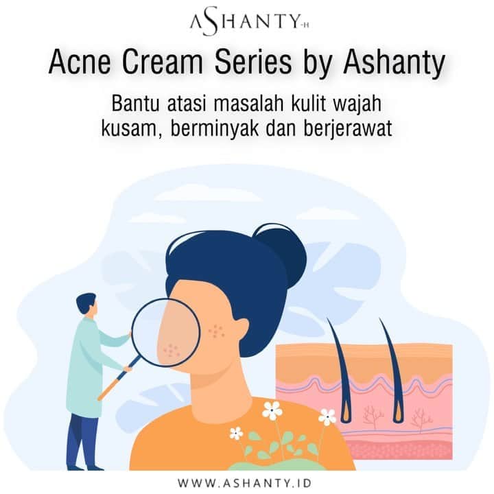 ASHANTY BEAUTY CREAM OFFICIALのインスタグラム：「Acne Cream Series membantu mengatasi masalah kulit wajah yang kusam, berminyak dan berjerawat.   Jangan biarkan jerawat menghantui, segera atasi dengan menggunakan Acne Cream Series by Ashanty 😍😍😍 Satu paket acne cream : • Facial Wash • Day Cream • Night Cream • Serum • Toner  • Exclusive Pouch  _____________________________ Informasi dan pemesanan  Ashanty Beauty Cream Chat Via WA : WA: 081287388885 WA: 085781140354 WA: 087778489900 WA: 081293823950 ⚡️ Fast Respons Click Link On Bio Instagram @ashantyid ❣️ ______________________________ #ashantybeautycream #creamashanty #skincareashanty #skincare #skincareartis #skincarelokal #creamwajah #creamperawatanwajah #obatjerawat #jerawat #kosmetik #krimwajah #creamwajah #whiteningcream #ashantyid #ashanty」