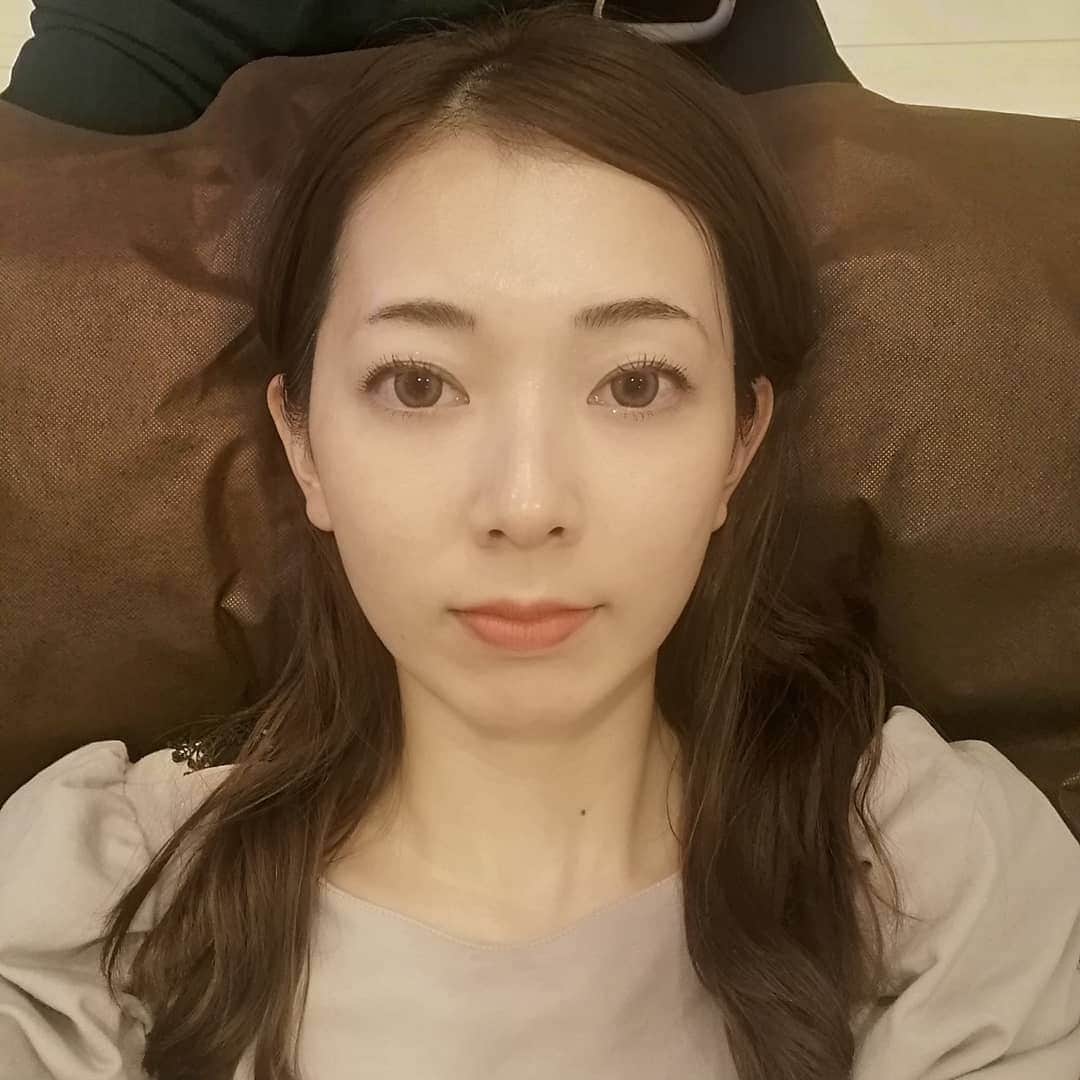 杉山由紀子さんのインスタグラム写真 - (杉山由紀子Instagram)「ずっと気になってたハイフ初体験✨ * * 最近美容づくしの杉山です♥️ やはりいつまでもキレイでいたいですよね♪ おうちでのスキンケアは当たり前にちゃんとやってますが✨ * フェイスラインが気になってくるお年頃🤭 今回は本格ハイフが初回4400円で施術可能な @eyecandyhifu の @laul_jiyugaoka さんに行ってきました✨ * 2回目以降も9900円で通うことができるのがここの良いところ♥️ * * ハイフって名前はわかるけどどういう感じなの？って私みたいにわからない方もまだいると思うので✨ それを今日はお伝えできたらと思います♪ * * 超音波で肌の筋膜にアプローチ✨ リフトアップがすぐにわかる人が多いらしい♥️ ってことでレポート♪ * * 痛みはピリピリすこし感じるくらい✨ 骨や歯が近いところは少し響く感じはありますが私は全然大丈夫でした🎵 * 所要時間は1時間くらい♪ ほんとあっという間でしたー♪ * * 違いわかるかな！？ フェイスラインと顎下念入りにやってもらいました🤭 最初は3回くらい続けるといいみたい🎵 まずは体験へぜひ♪ * * #eyecandyhifu #eyecandy #ウルトラVハイフ #ハイフ #HIFU #小顔 #リフトアップ #フェイシャル #エステ #美容 #たるみ改善 #小顔効果 #たるみ #アンチエイジング #フェイスライン #自由が丘」10月23日 10時40分 - yukikosugiyama
