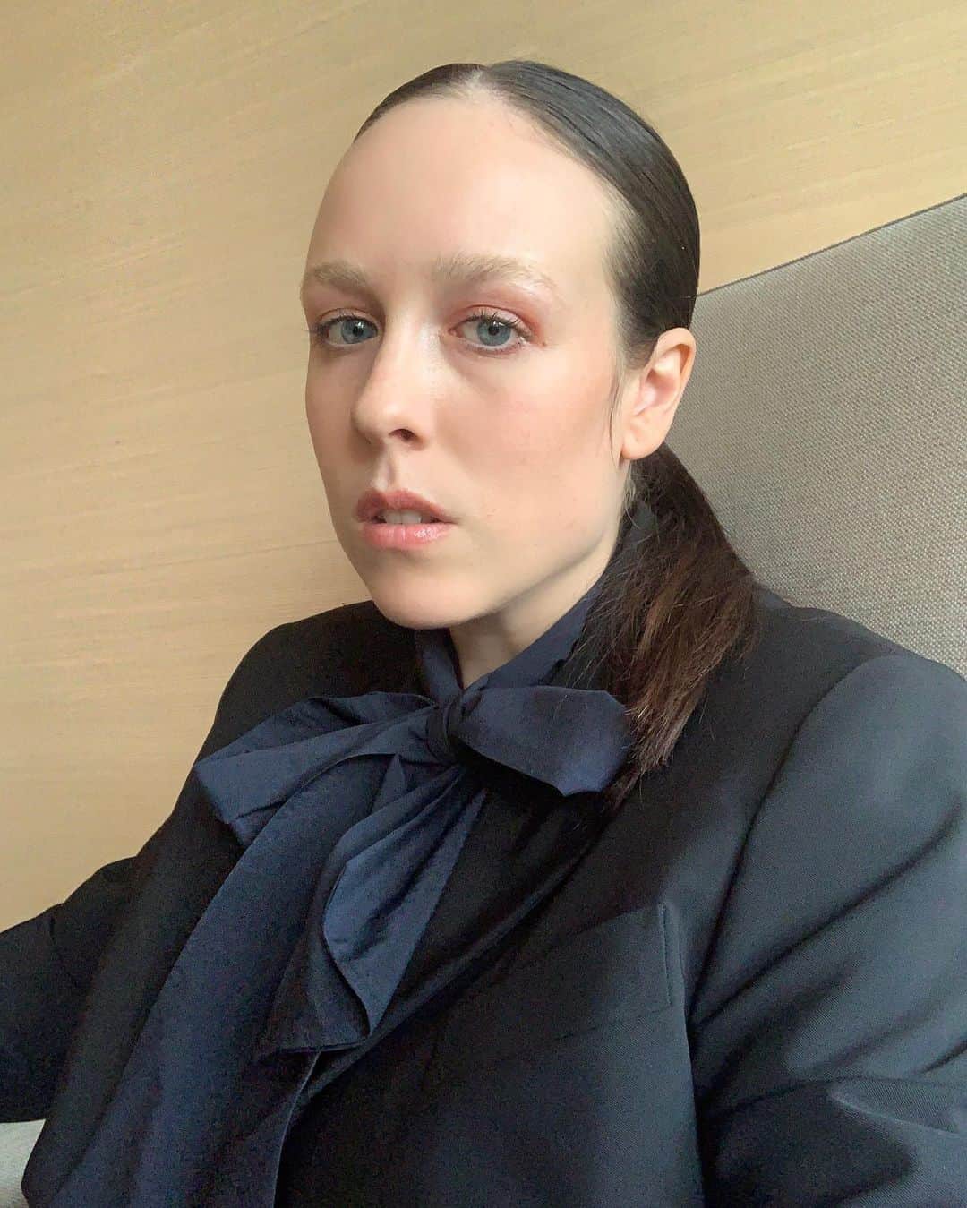 アリー・エックスのインスタグラム：「Does insurance cover skin tag removal ? Or is that considered cosmetic ?」