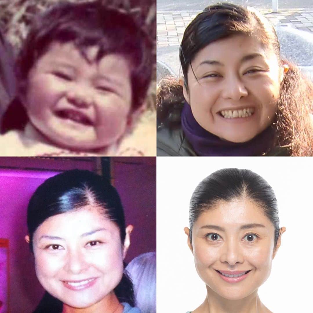 間々田佳子のインスタグラム：「ビフォーアフター❣️ 赤ちゃんよしこ初登場！笑笑  顔の動きを変えれば 顔はある程度変わるんだよっ  と伝えたいだけ 自分のお顔と会話することが大事❣️  顔は面白い！  みなさんの顔を変えることが私の仕事💪  #コアフェイストレーニング #目元のシワも改善できる 今日はそこまでお伝えできず ごめんなさいっ  まずは今日のエクササイズを 継続してみてくださーい！」