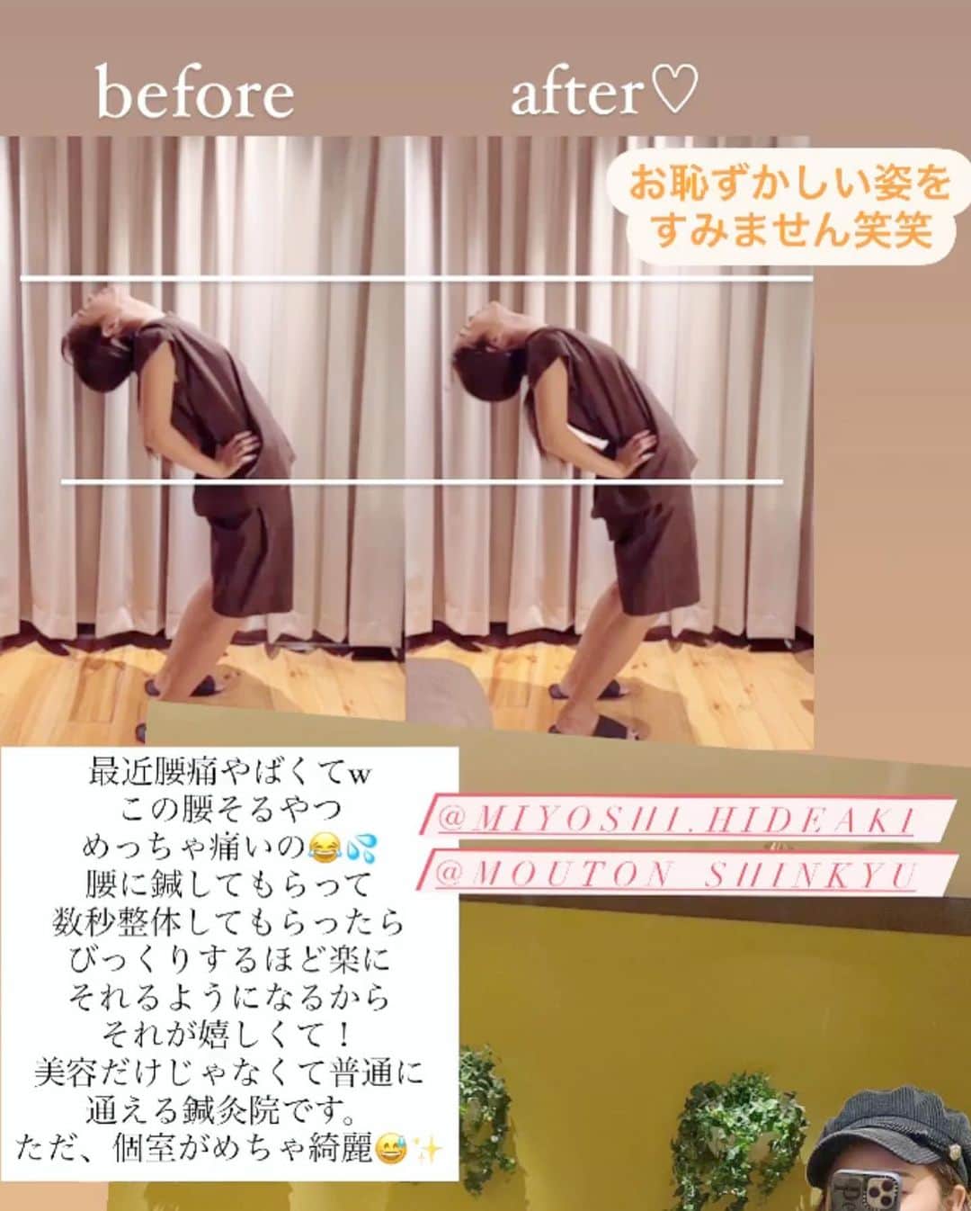 藤森マリナさんのインスタグラム写真 - (藤森マリナInstagram)「後ろ姿も綺麗な人になる💛 * * 年々女性として 見られたいところが変わってきて？ 増えて？ ケアするところも増えて 大変ですが楽しんで 頑張ってるまりなはんです😌💭 * * このスタイルシンプルに見えるけど 実は後ろが#紐アレンジ で めためた可愛いの🥺♥️ そして花嫁といえば背中！！ だからこの撮影の前日には 信頼している美容鍼で 継続して頑張ってる背中ケアを してきたよ✊🏻💨 * * まだまだ新しいニキビもできちゃうし 昔の色素沈着もあるけど 三好先生に言われた通りに 保湿頑張ってたら 背中の肌質が変わってきた！！✨ 長い道のりかもしれないけど ツルツル背中目指して 鍼と保湿ケアをもう少し 頑張っていきます🔥 * * ついでに三好先生は 本当に素晴らしい技術をお持ちで 触診にも自信がある！！ って先生自身が言ってくれたれ こちらも安心して任せられるし 首凝り、腰痛、姿勢の悩みとかも 鍼治療で緩和させられたり 仕事で疲れてる男性諸君の皆様には 是非ここの美顔ジムもおすすめしたい♡ ジムと書いてるけど あなたは寝転がってるだけです😂 ほんまにこのあたまへの電流は 新感覚やしめっちゃスッキリするから 是非受けて欲しい！！ まりなはんのインスタ見たでもいいし 何かしら常にキャンペーンやってたりするから DMで問い合わせてみてね📩✨ * * ☑︎大阪院→ @mouton_shinkyu ☑︎東京院→ @acupa.salon ☑︎先生→ @miyoshi.hideaki」10月26日 19時15分 - maaarina0806