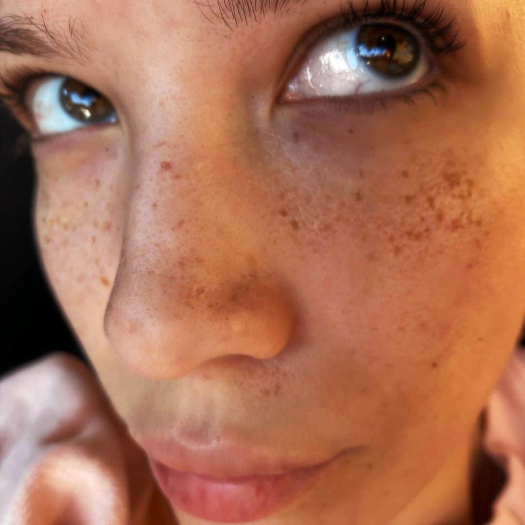 Halseyのインスタグラム：「I get new freckles every day I think 🍄」